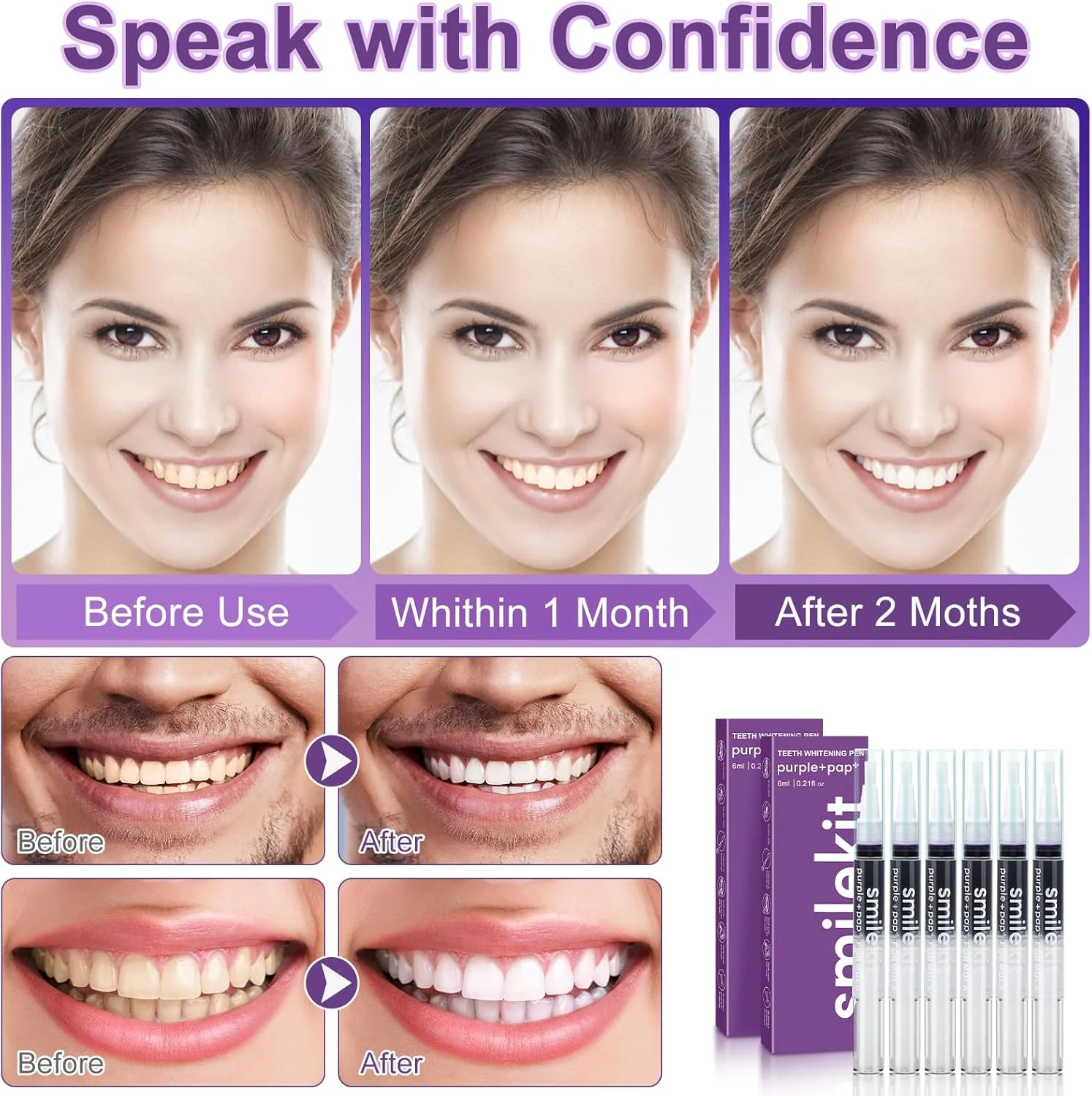 قلم سفید کننده دندان، بسته 6 عددی قلم سفید کننده دندان، سفید کننده دندان برای دندان های سفیدتر، حذف موثر لکه های چای قهوه و نیکوتین