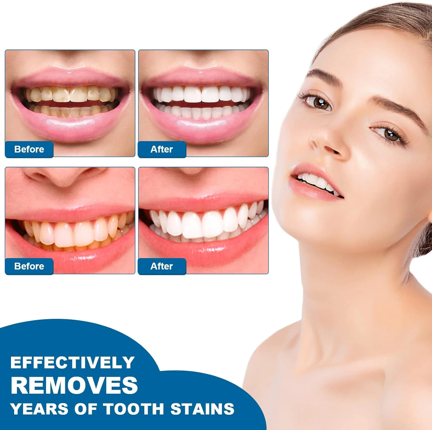 قلم سفید کننده دندان 3 عددی، از بین برنده فوری لکه، حذف کننده قوی لکه، کاهش زردی