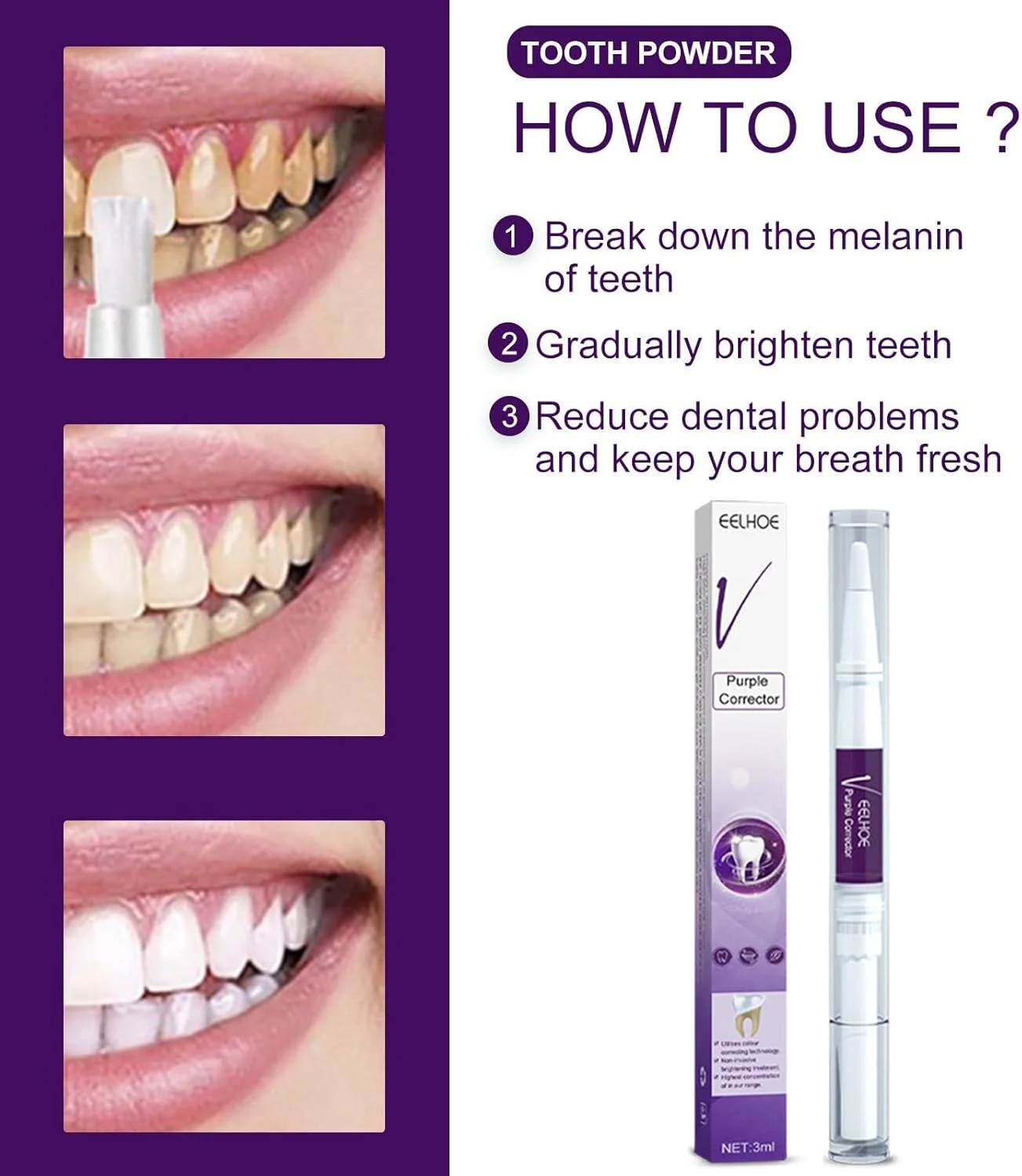 قلم سفید کننده دندان، سرم سفید کننده دندان در طول شب، اسانس سفید کننده دندان، عامل سفید کننده دندان، قلم سفید کننده دندان لبخند شما را تنها در یک هفته روشن می کند، یک ژل سفید کننده ملایم و ایمن برای مینای دندان