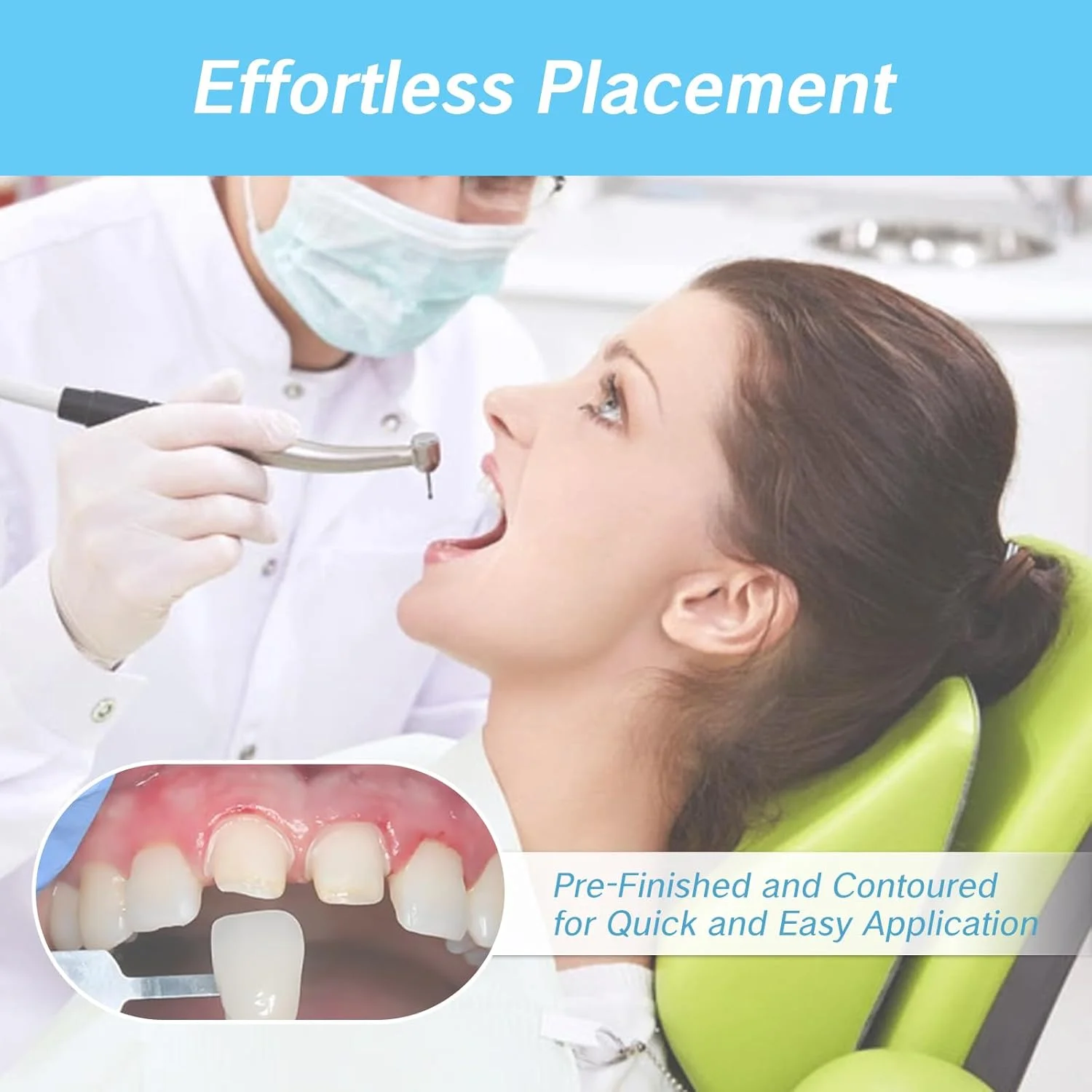 ۱۰۰ عدد روکش موقت دندان، کیت روکش دندان با کلاهک های آسیاب، روکش های دندانی فوری برای بزرگسالان، کیت ترمیم کلاهک دندان های شکسته برای استفاده قدامی خلفی ۱۰۰ عدد روکش موقت دندان، کیت روکش دندان با کلاهک های آسیاب، روکش های دندانی فوری برای بزرگسالان، کیت ترمیم کلاهک دندان های شکسته برای استفاده قدامی خلفی