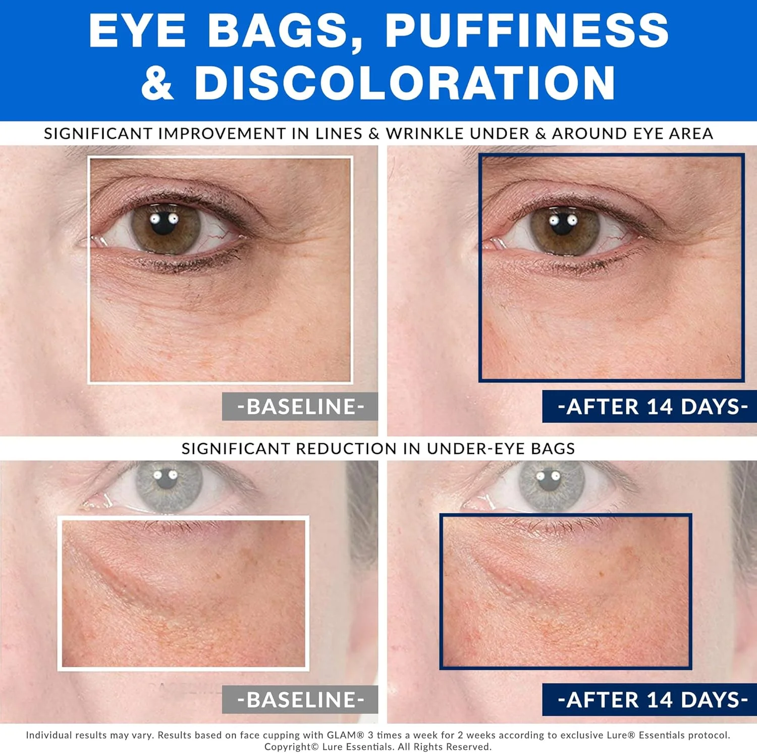 مجموعه لیوان های ماساژ صورت Lure Essentials - لیوان های شیشه ای مکش صورت برای لیفت صورت، چین و چروک و ماساژ لنفاوی ضد سلولیت (04 - چشم و لب)