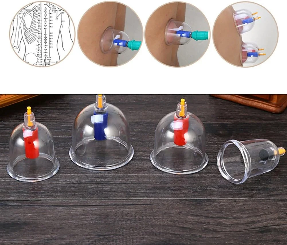 مجموعه ۲۴ عددی بادکش ماساژ Alucyy، مجموعه چند منظوره بادکش درمانی U شکل با لوله افزایش طول، فنجان های مکش خلاء برای استفاده بدن و کمر