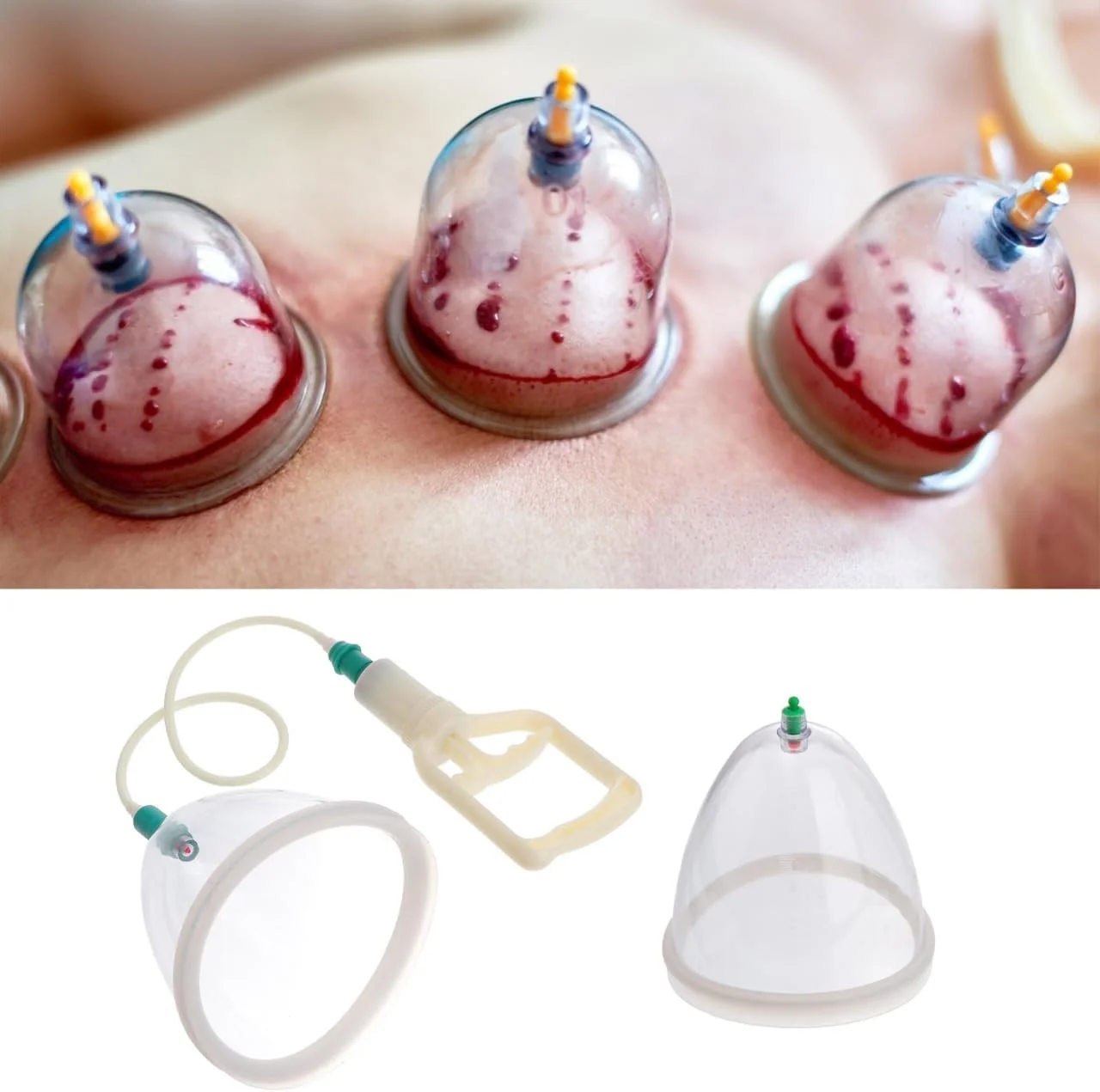 دستگاه حجامت COLLBATH، بسته 2 عددی، دستگاه حجامت خلاء قابل حمل برای تسکین موثر فاسیا و آرامش عضلات