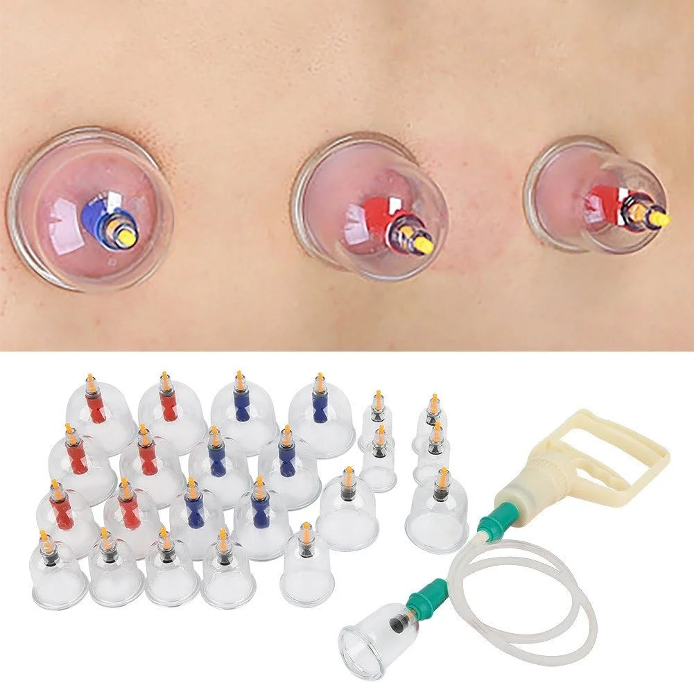 تجهیزات حجامت، 24 عدد فنجان ABS U شکل، ست حجامت خلاء چینی، ماساژ درمانی، طب سوزنی مکشی با لوله اتصال تجهیزات حجامت، 24 عدد فنجان ABS U شکل، ست حجامت خلاء چینی، ماساژ درمانی، طب سوزنی مکشی با لوله اتصال