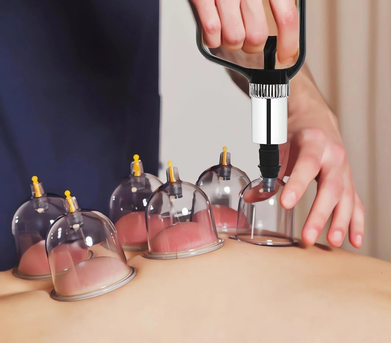 مجموعه حجامت ۱۶ لیوان، سایز بزرگ V2.0 برای زنان و مردان، لیوان خلاء برای تسکین درد عضلات بدن و کمر، ماساژ، دستگاه مکش سلولیت