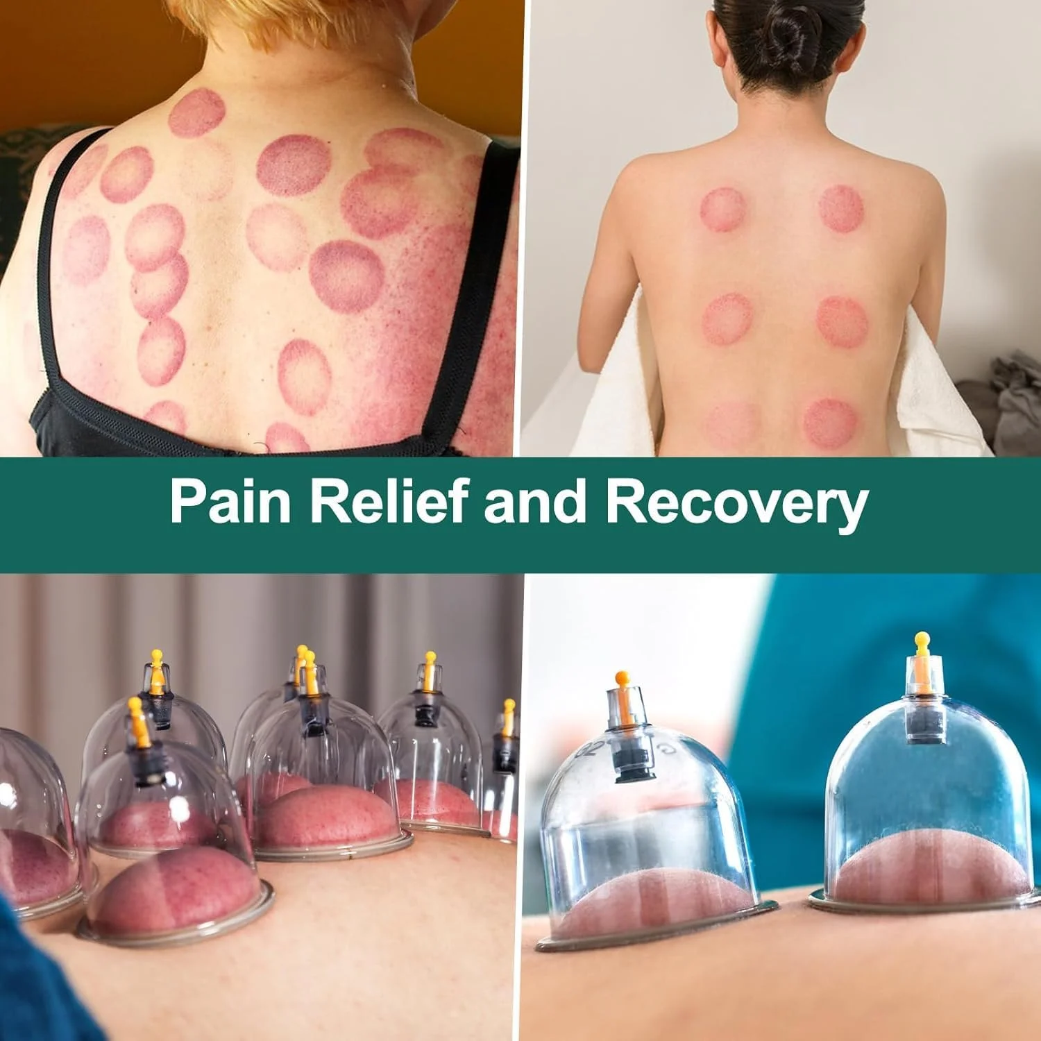 مجموعه حجامت ۱۶ لیوان، سایز بزرگ V2.0 برای زنان و مردان، لیوان خلاء برای تسکین درد عضلات بدن و کمر، ماساژ، دستگاه مکش سلولیت