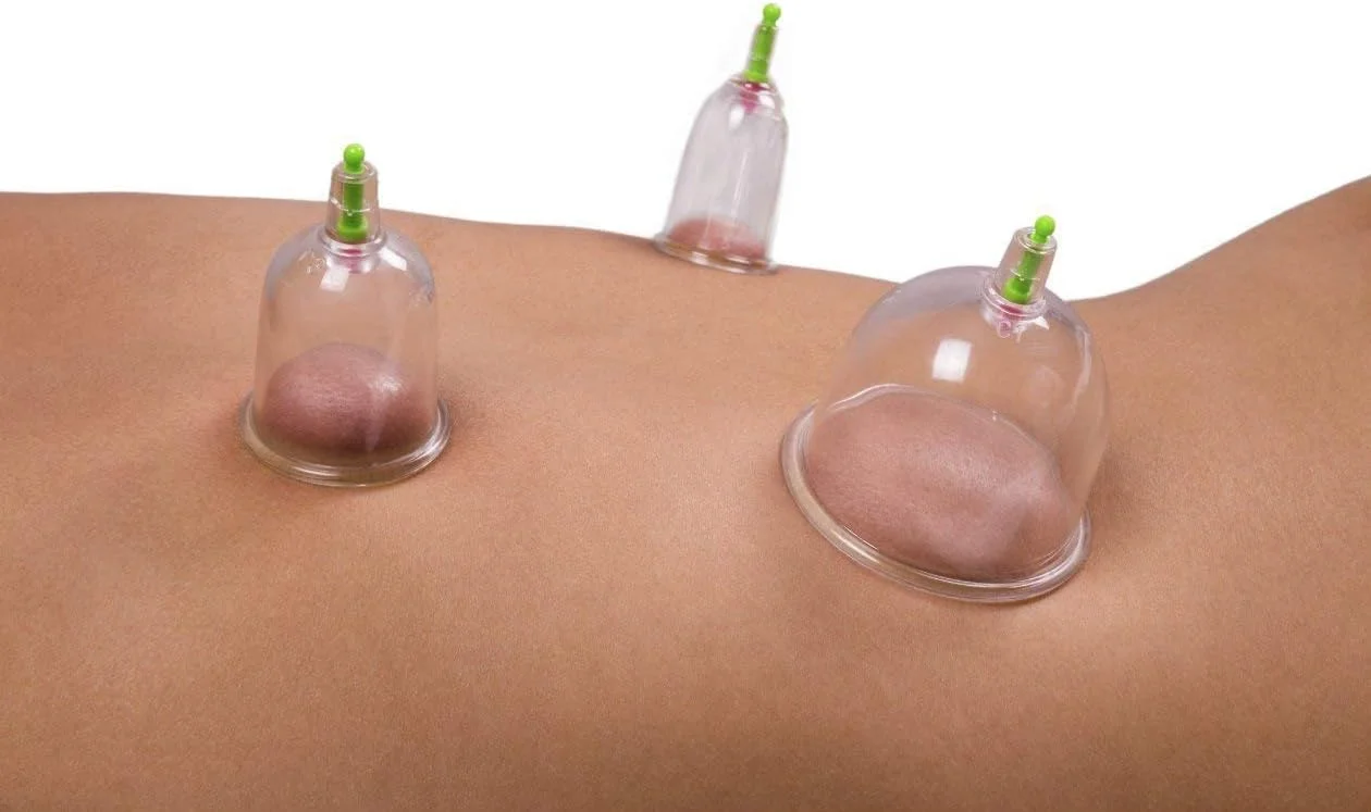 مجموعه ۱۲ عددی فنجان ماساژ درمانی، مجموعه فنجان ماساژ حرفه ای بدن، فنجان درمانی بیومغناطیسی با پمپ خلاء + هدیه رایگان "ژل آلوئه ورا ۹۲٪ ۳۰۰ میلی لیتر"