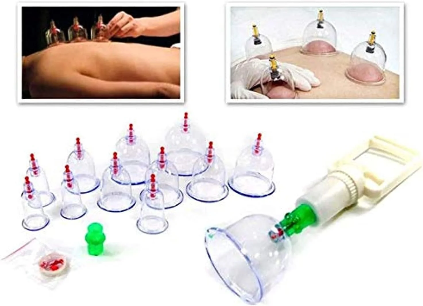 دستگاه حجامت مکشی با لیوان های پلاستیکی