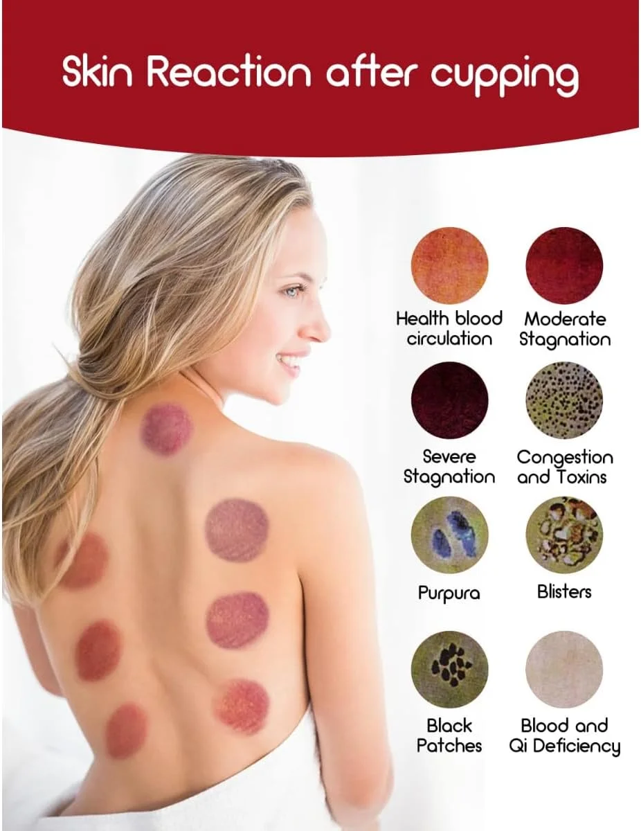 ماساژور حجامت برقی هوشمند 4 در 1 | درمان وکیوم، گواشا، خراش و رفع سلولیت | 12 سطح گرما و مکش | تسکین هوشمند خستگی برای صورت و بدن | دستگاه حجامت مک راس