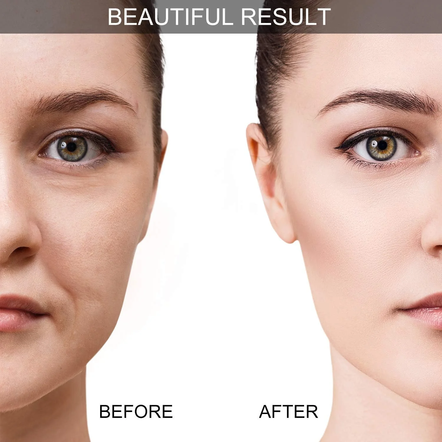 مجموعه ۷ عددی ماساژ ضد سلولیت FUNI با برس لایه بردار، فنجان های ماساژ خلاء برای کمک به کاهش چین و چروک و علائم پیری، مناسب برای پاها، صورت، چشم ها و نواحی گردن (سفید)