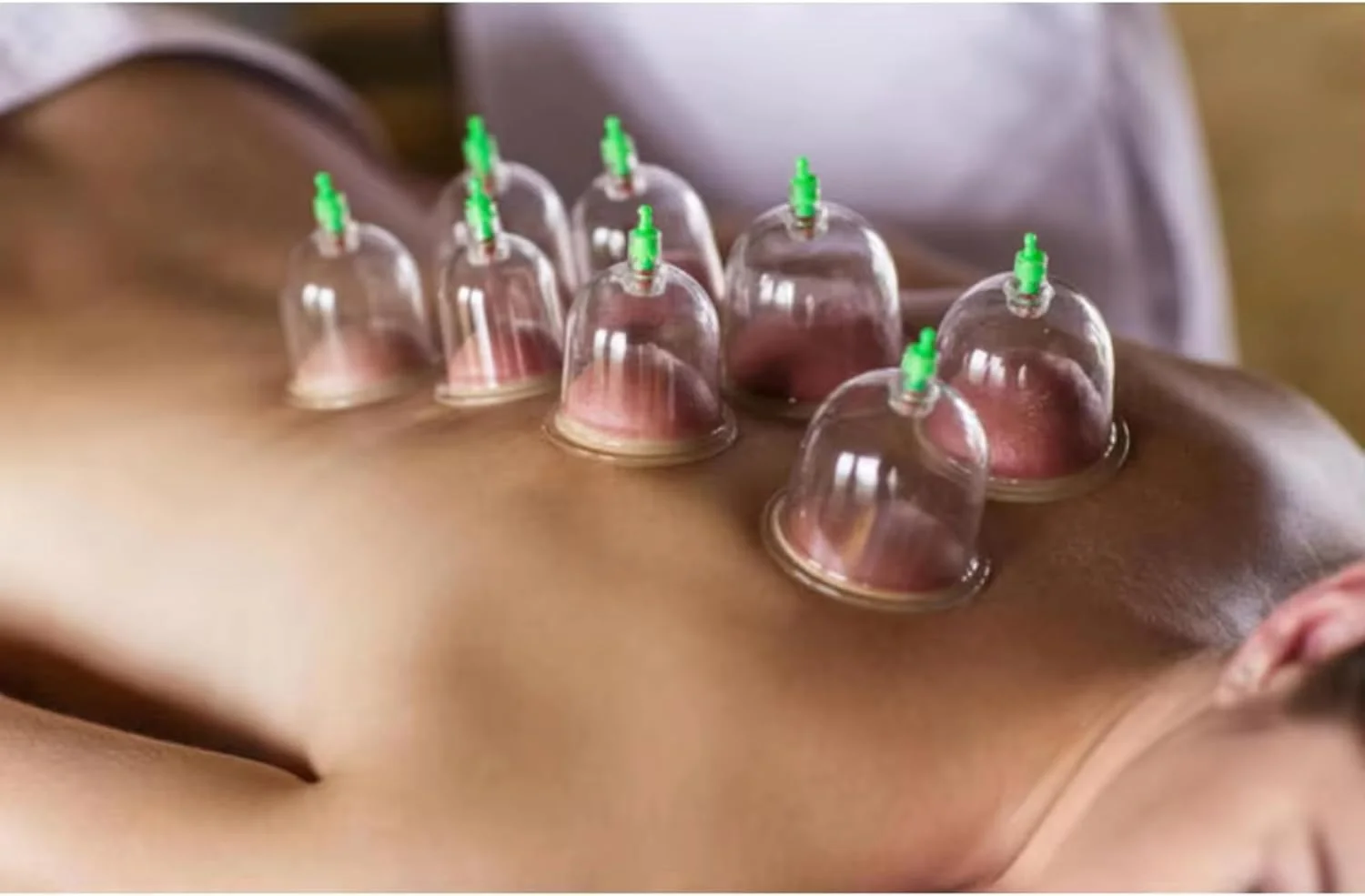 مجموعه حجامت اسلامی، مجموعه ماساژ، کیت مکش خلاء ۱۲ تکه