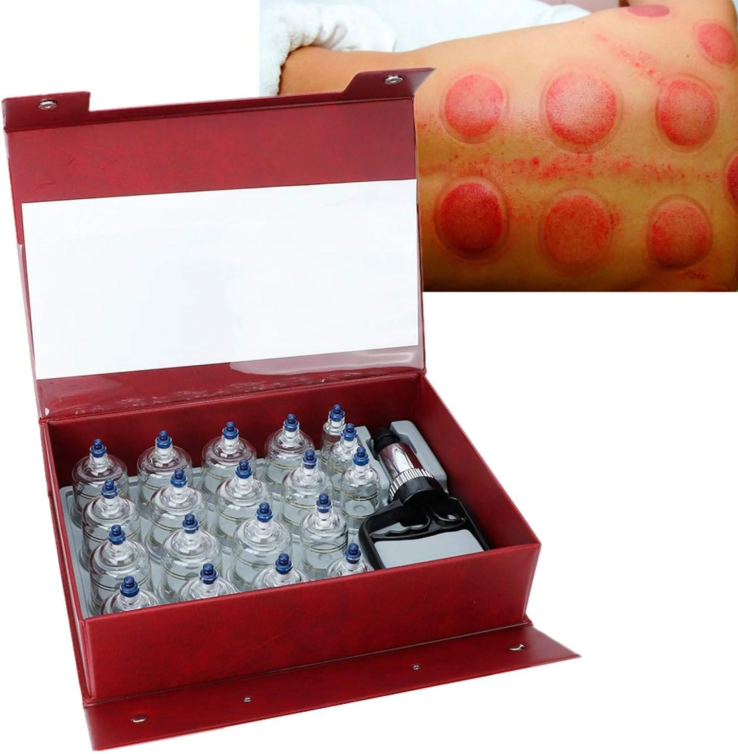 مجموعه های حجامت درمانی، مجموعه ۱۹ عددی حجامت ضخیم با پمپ خلاء، مجموعه های حرفه ای طب سوزنی چینی، ماساژ درمانی کامل بدن برای زنان/مردان/پدر/مادر، دارای تاییدیه CE