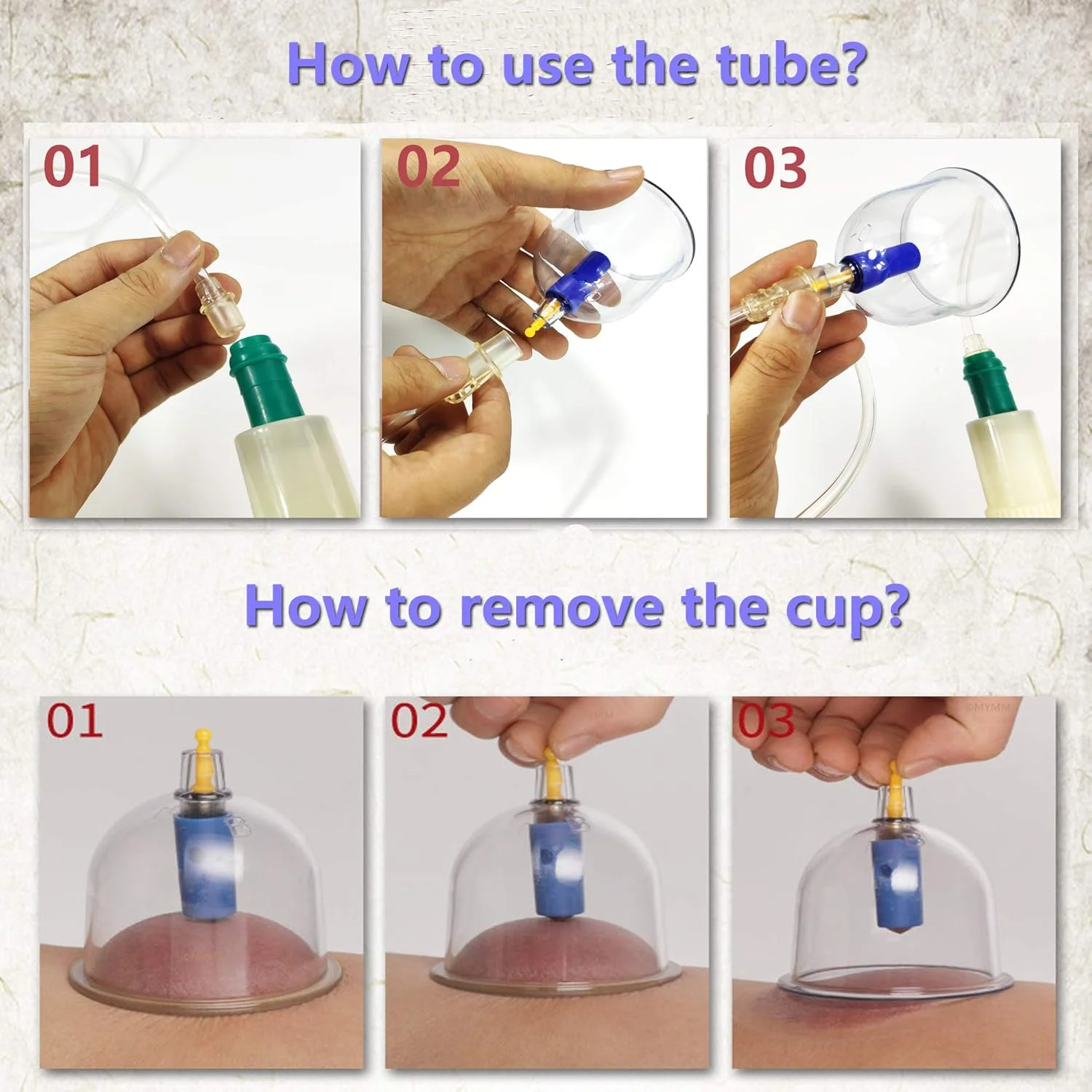مجموعه ۲۴ عددی فنجان حجامت، مغناطیسی، طب سنتی چینی، مناسب استفاده خانگی، کیت مکش وکیوم / مجموعه فنجان حجامت پزشکی ماساژ چینی، طب سوزنی مکشی مجموعه ۲۴ عددی فنجان حجامت، مغناطیسی، طب سنتی چینی، مناسب استفاده خانگی، کیت مکش وکیوم / مجموعه فنجان حجامت پزشکی ماساژ چینی، طب سوزنی مکشی