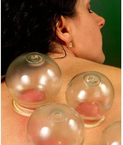 مجموعه حرفه ای لیوان حجامت شیشه ای سایز شماره 5 (8 عدد در هر ست) مجموعه حرفه ای لیوان حجامت شیشه ای سایز شماره 5 (8 عدد در هر ست)