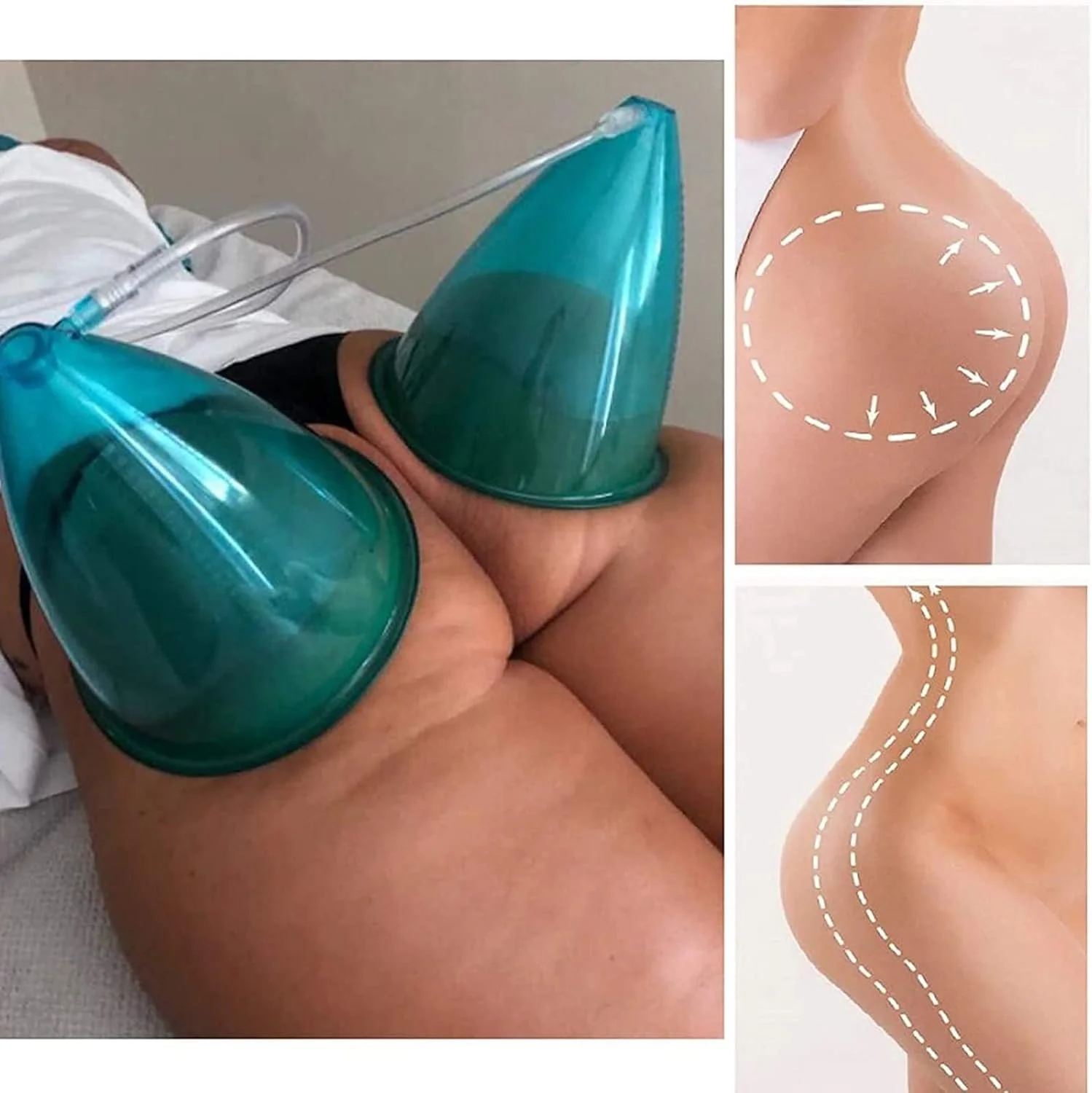 لوازم جانبی دستگاه کاپینگ وکیوم PIKIS، کاپ های مکش وکیوم XXL ممتاز برای دستگاه ماساژ فرم دهی بدن، 1 جفت کاپینگ - ست های درمانی لوازم جانبی دستگاه کاپینگ وکیوم PIKIS، کاپ های مکش وکیوم XXL ممتاز برای دستگاه ماساژ فرم دهی بدن، 1 جفت کاپینگ - ست های درمانی