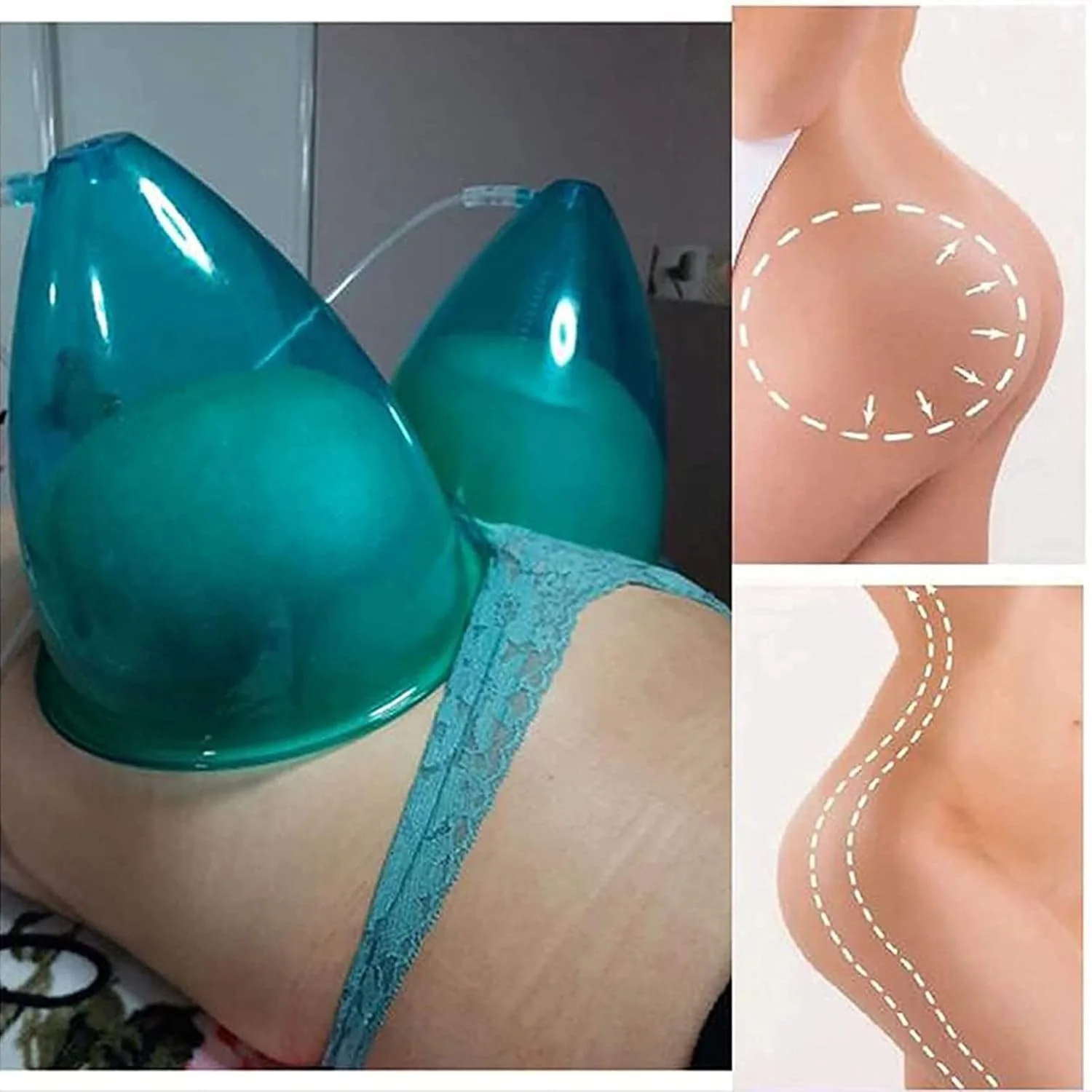 پیکیز 2 عدد کاپ ماساژ وکیوم سایز بزرگ 180 میلی لیتری، لوازم جانبی دستگاه کاپینگ وکیوم با شلنگ Y شکل برای فرم دهی باسن و ماساژ بدن پیکیز 2 عدد کاپ ماساژ وکیوم سایز بزرگ 180 میلی لیتری، لوازم جانبی دستگاه کاپینگ وکیوم با شلنگ Y شکل برای فرم دهی باسن و ماساژ بدن