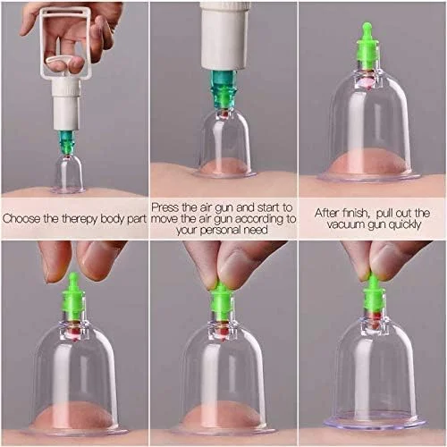 مجموعه 6 عددی فنجان حجامت، طب سوزنی و ماساژ PrePsto، ابزار مکش خلاء، ماساژور ریلکسی بدن، پمپ های مکش مجموعه 6 عددی فنجان حجامت، طب سوزنی و ماساژ PrePsto، ابزار مکش خلاء، ماساژور ریلکسی بدن، پمپ های مکش