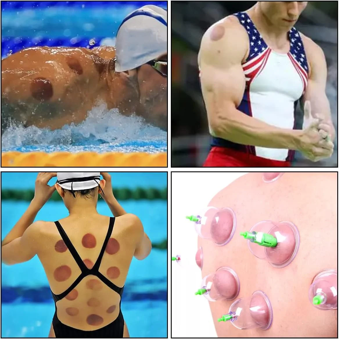 مجموعه حرفه ای لیوان حجامت - لیوان های حجامت با پمپ خلاء - حجامت پزشکی با کیفیت بالا با آهنرباهای درمانی - لیوان حجامت حرفه ای برای رفع تنش و سلولیت برای درمان فاسیا مجموعه حرفه ای لیوان حجامت - لیوان های حجامت با پمپ خلاء - حجامت پزشکی با کیفیت بالا با آهنرباهای درمانی - لیوان حجامت حرفه ای برای رفع تنش و سلولیت برای درمان فاسیا