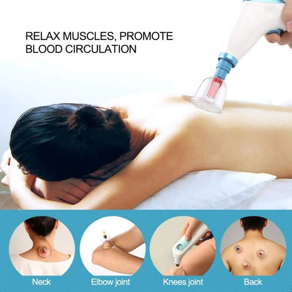 مجموعه حجامت برقی SHKY، طب سوزنی مکشی سنتی خانگی - مراقبت از سلامت بدن و ماساژ زیبایی، تسکین درد مفاصل و عضلات (12 قطعه)