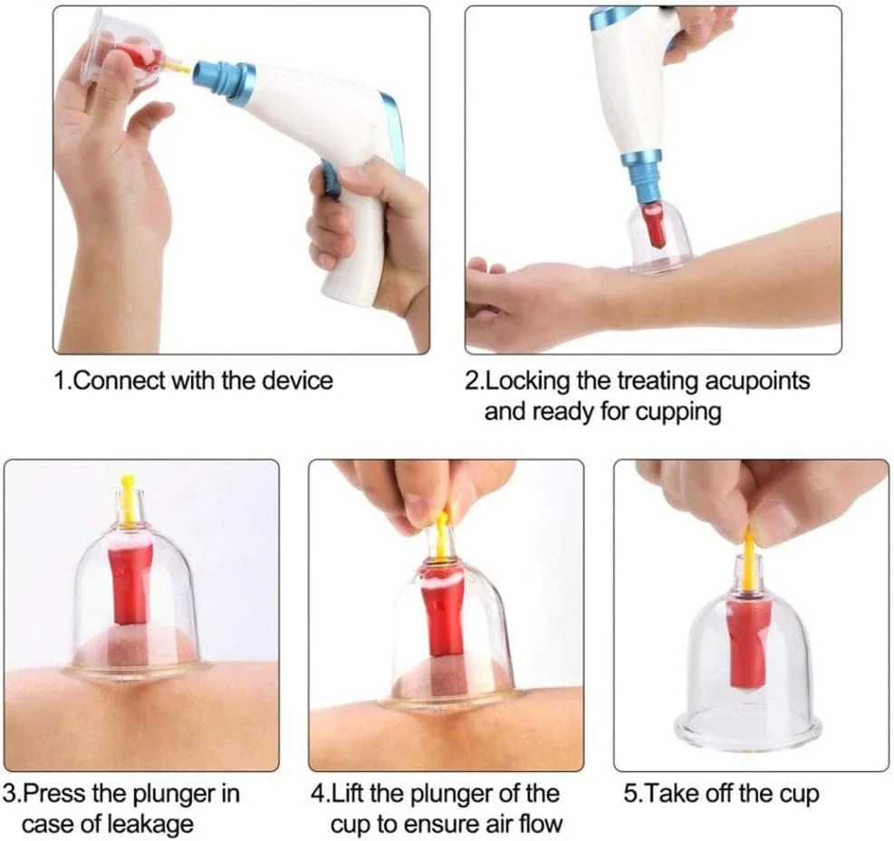مجموعه حجامت برقی SHKY، طب سوزنی مکشی سنتی خانگی - مراقبت از سلامت بدن و ماساژ زیبایی، تسکین درد مفاصل و عضلات (12 قطعه)