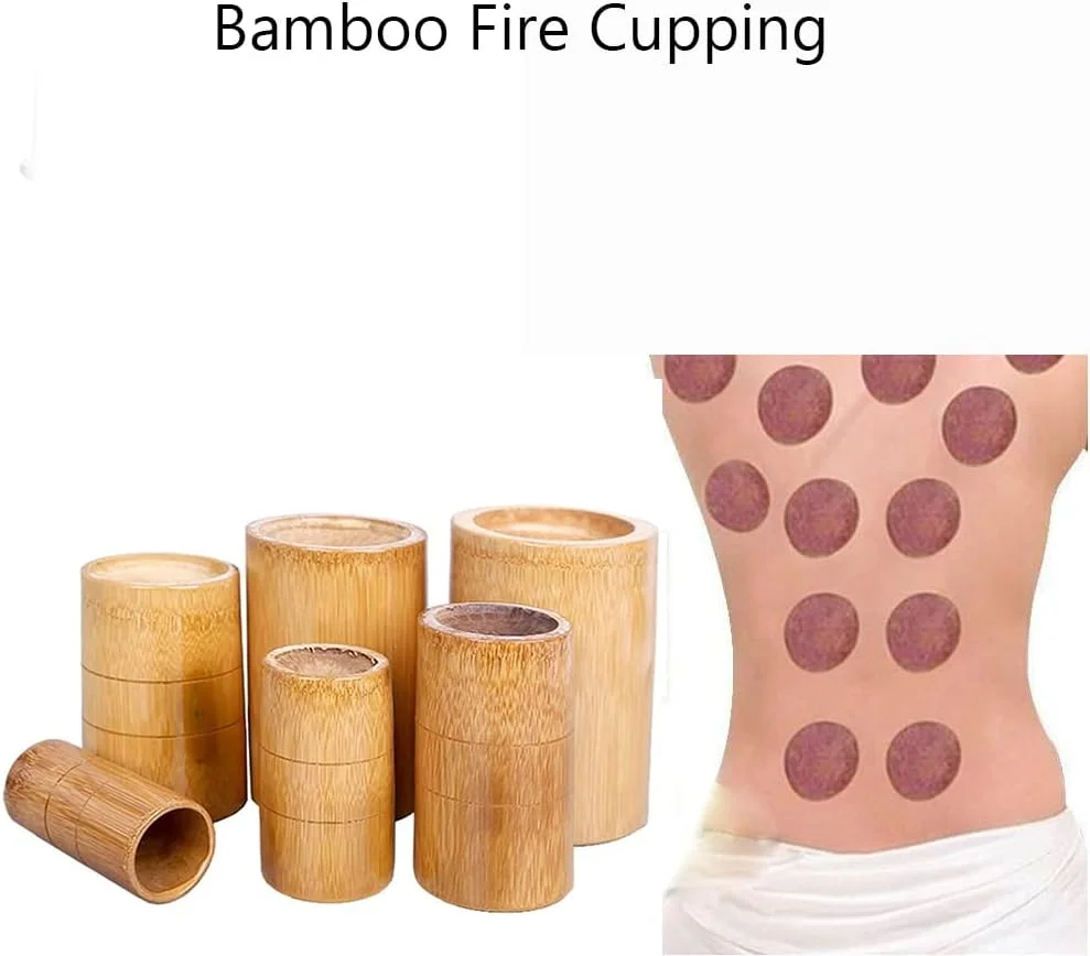 مجموعه حجامت ZCBYBT، مجموعه ظروف حجامت چینی، ظروف حجامت آتش بامبو با اندازه های مختلف، 9 فنجان