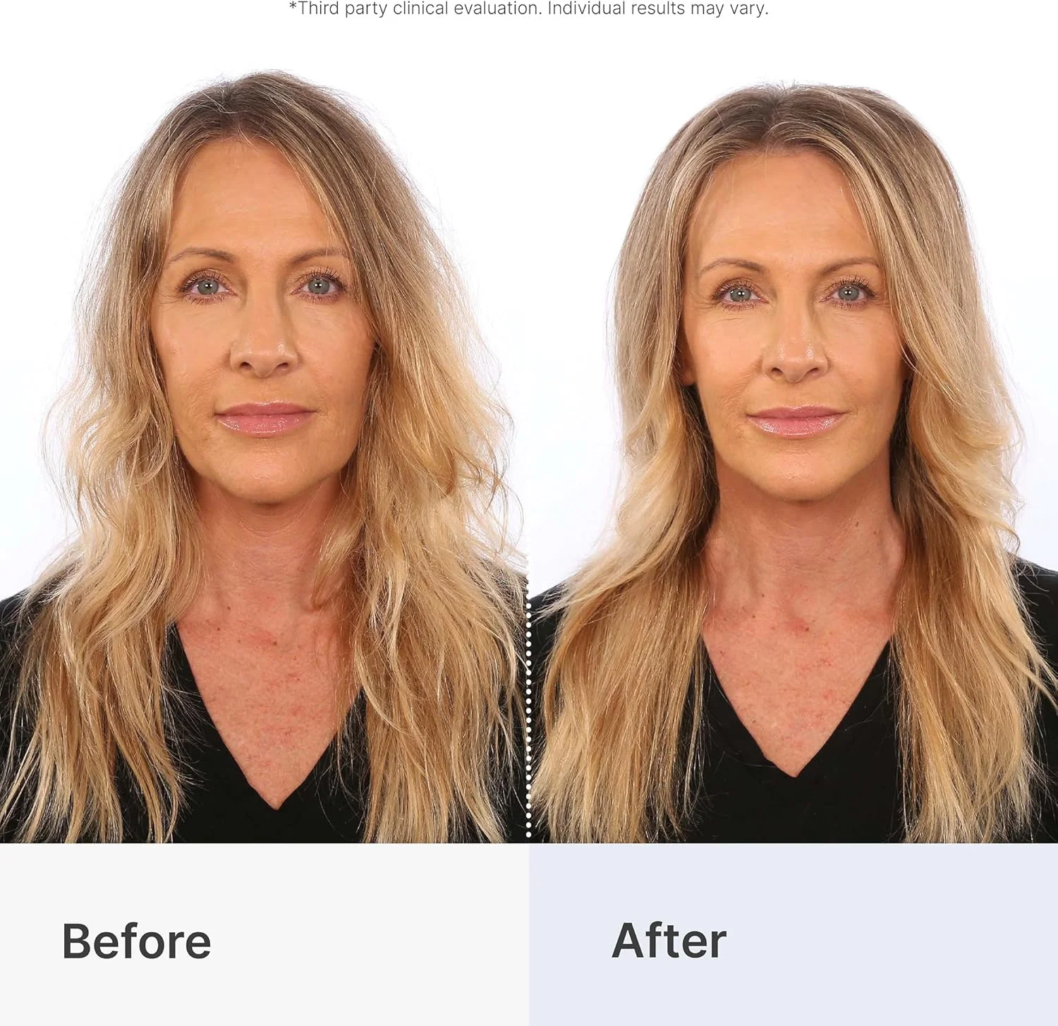 اسپری حجم دهنده مو برای موهای نازک و کم پشت – فرمولاسیون بیوتین و بامبو – افزایش فوری حجم و استحکام – نگهدارنده قوی و انعطاف پذیر – مناسب برای خانم ها – 177 میلی لیتر