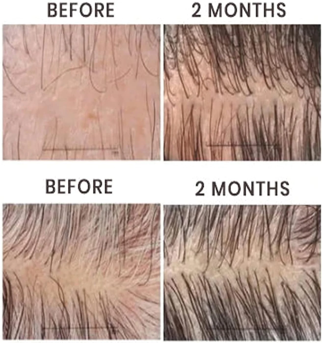 اسپری ترمیم کننده پوست سر موی زیتون بلوسومز، اسپری سرم فرمول رشد مو بلوسومز، اسپری روغن زیتون مو، محصولات روغن زیتون ترمیم کننده پوست سر برای موهای خشک، وز و آسیب دیده (1 عدد)