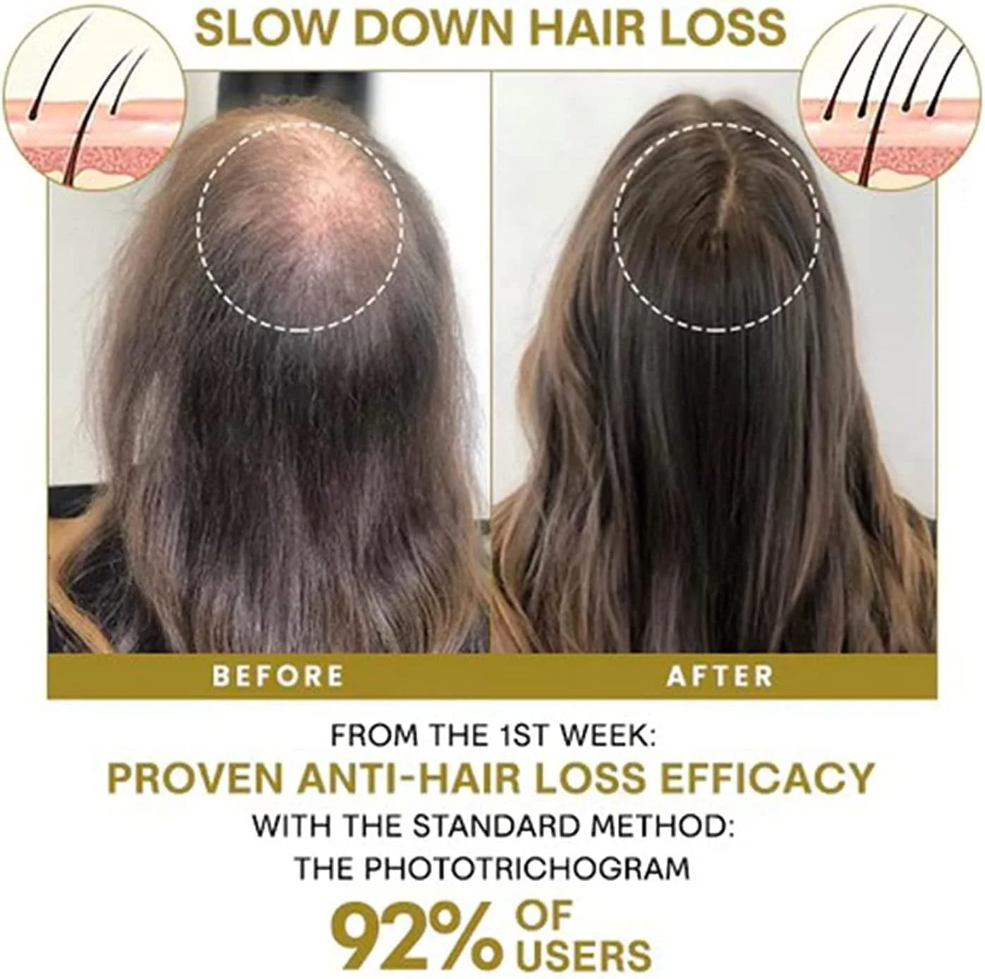 اسپری ترمیم کننده پوست سر موی زیتون بلوسومز، اسپری سرم فرمول رشد مو بلوسومز، اسپری روغن زیتون مو، محصولات روغن زیتون ترمیم کننده پوست سر برای موهای خشک، وز و آسیب دیده (1 عدد)