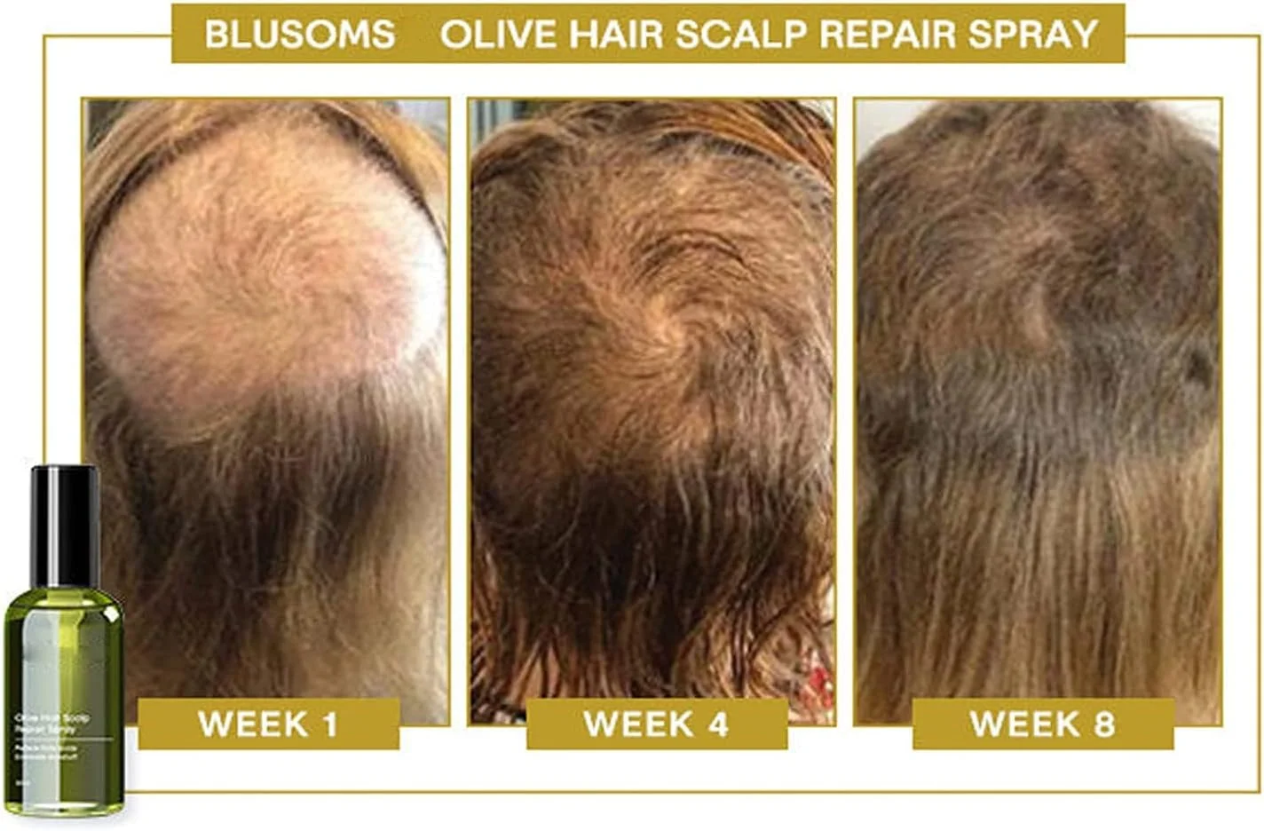 اسپری ترمیم کننده پوست سر موی زیتون بلوسومز، اسپری سرم فرمول رشد مو بلوسومز، اسپری روغن زیتون مو، محصولات روغن زیتون ترمیم کننده پوست سر برای موهای خشک، وز و آسیب دیده (1 عدد)