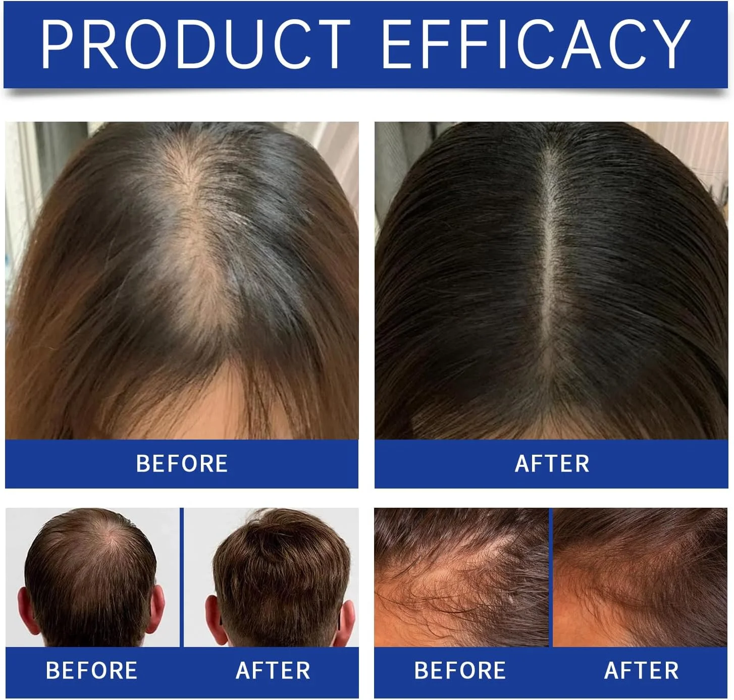 اسپری مو پپتید مس برای رشد مو - سرم مو پپتیدی حاوی Polygonum Multiflorum مناسب برای انواع مو