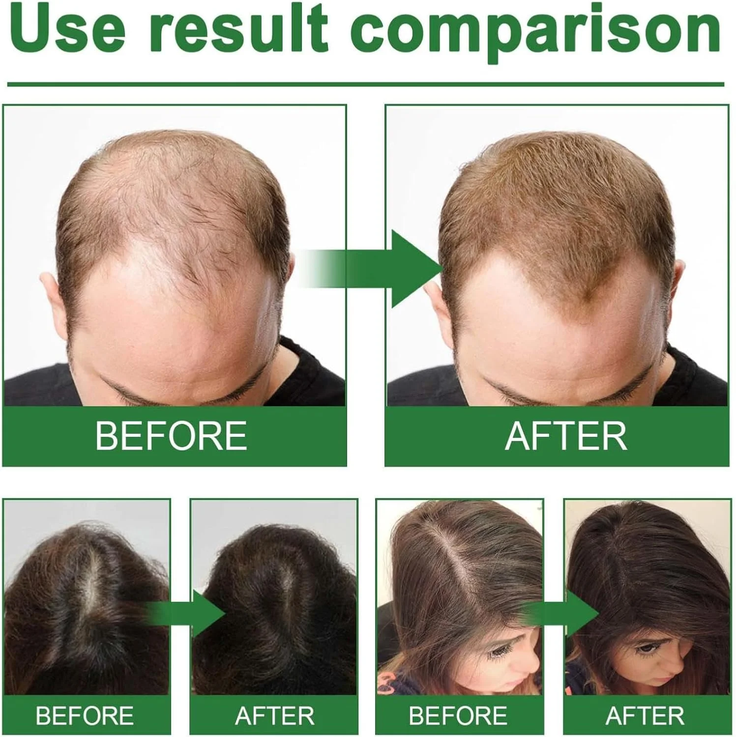 اسپری مو رزماری، اسپری تقویت کننده روزانه آب رزماری، اسپری متراکم کننده مو، مرطوب کننده مو، احیا کننده درخشش، افزایش دهنده خاصیت ارتجاعی و اسپری (3 عدد)