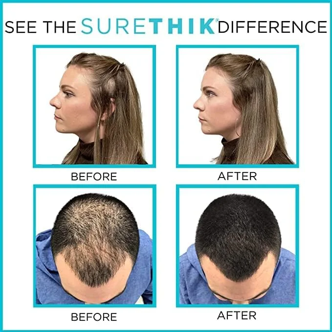 پودر پرپشت کننده موی سر SureThik، 15 گرم و اسپری تثبیت کننده فیبر، 125 میلی لیتر (مشکی)