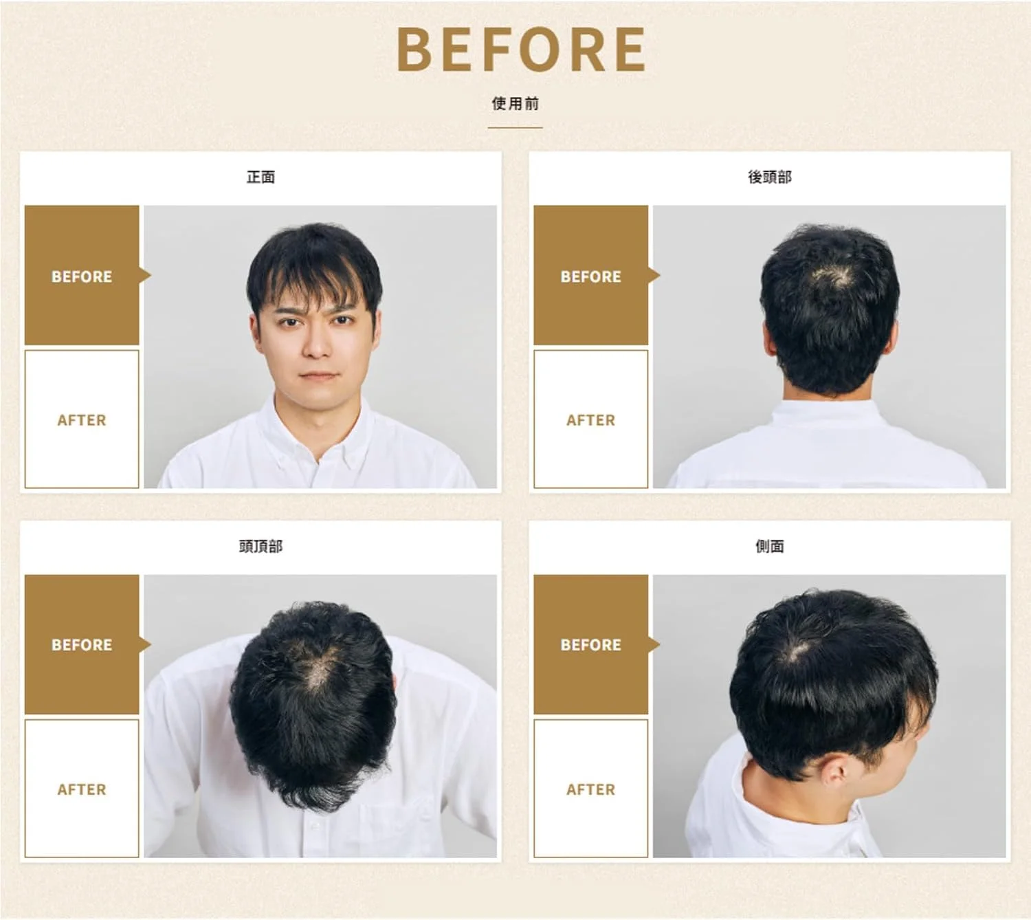 اسپری پوشش سریع مو ماسینی [اوتنا] (مشکی) ۱۴۰ گرمی (۳ عدد)