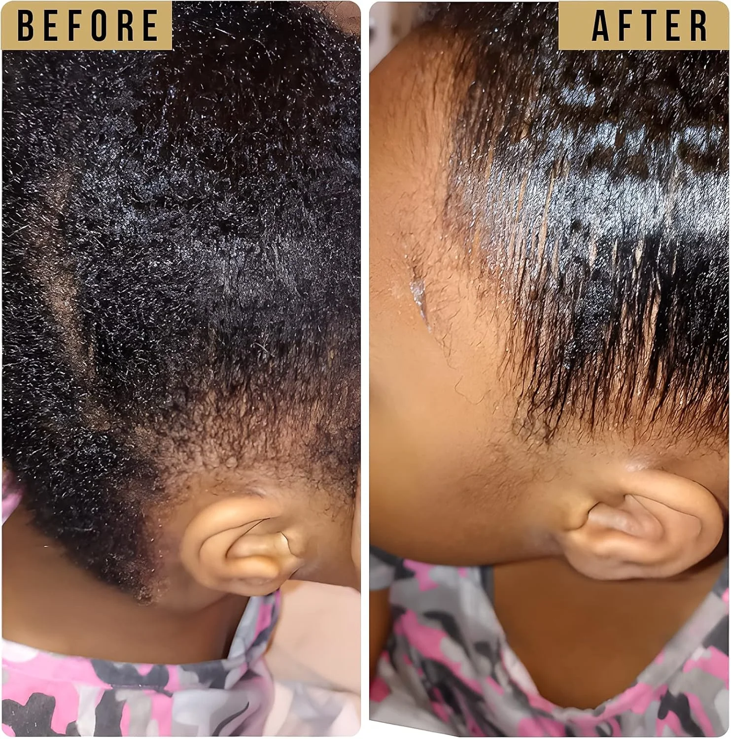 استیک واکس مو SOVONCARE برای کلاه گیس، استیک حالت دهنده مو، واکس حالت دهنده غیر چرب، ماندگاری طولانی، محصول حالت دهنده موی موقت با قدرت نگهدارندگی قوی برای موهای وز، سایز جیبی 80 گرم استیک واکس مو SOVONCARE برای کلاه گیس، استیک حالت دهنده مو، واکس حالت دهنده غیر چرب، ماندگاری طولانی، محصول حالت دهنده موی موقت با قدرت نگهدارندگی قوی برای موهای وز، سایز جیبی 80 گرم