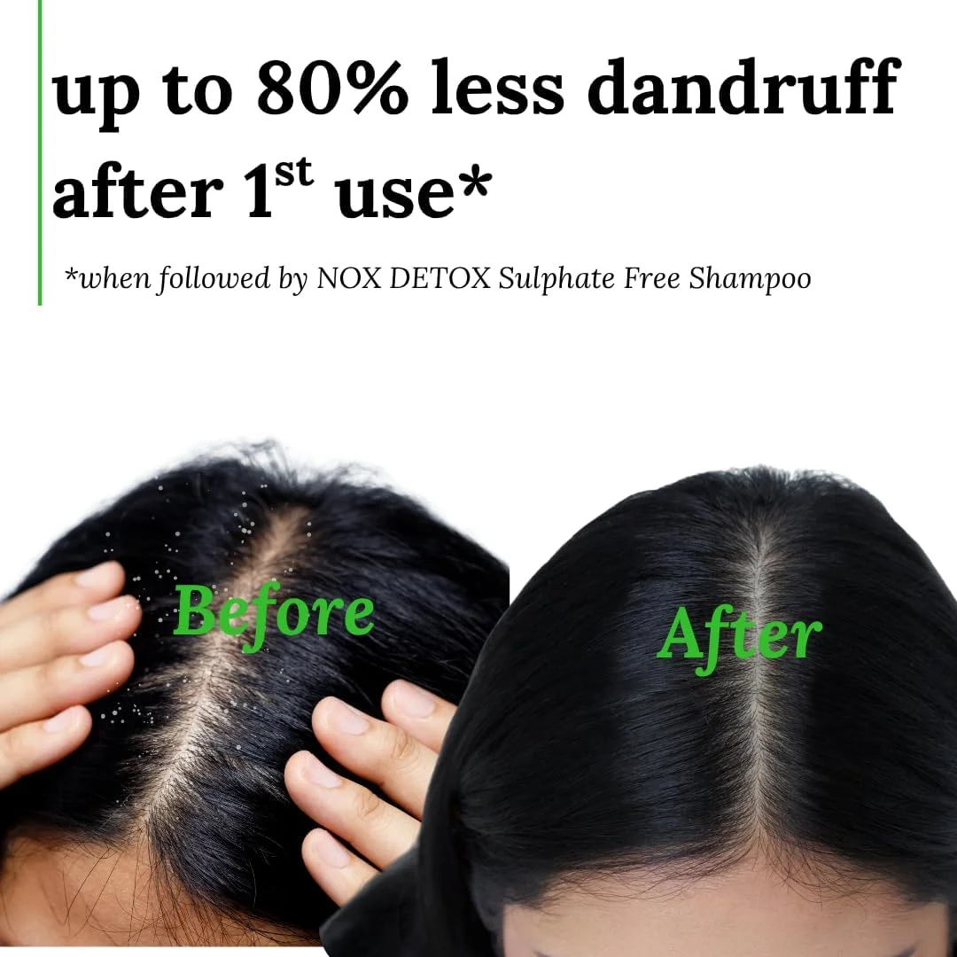 ماسک موی لیمو برای شوره سر، مناسب پوست سر خشک تا چرب، برای آقایان و بانوان با موهای معمولی تا فر، بدون سولفات و پارابن، 1 عدد