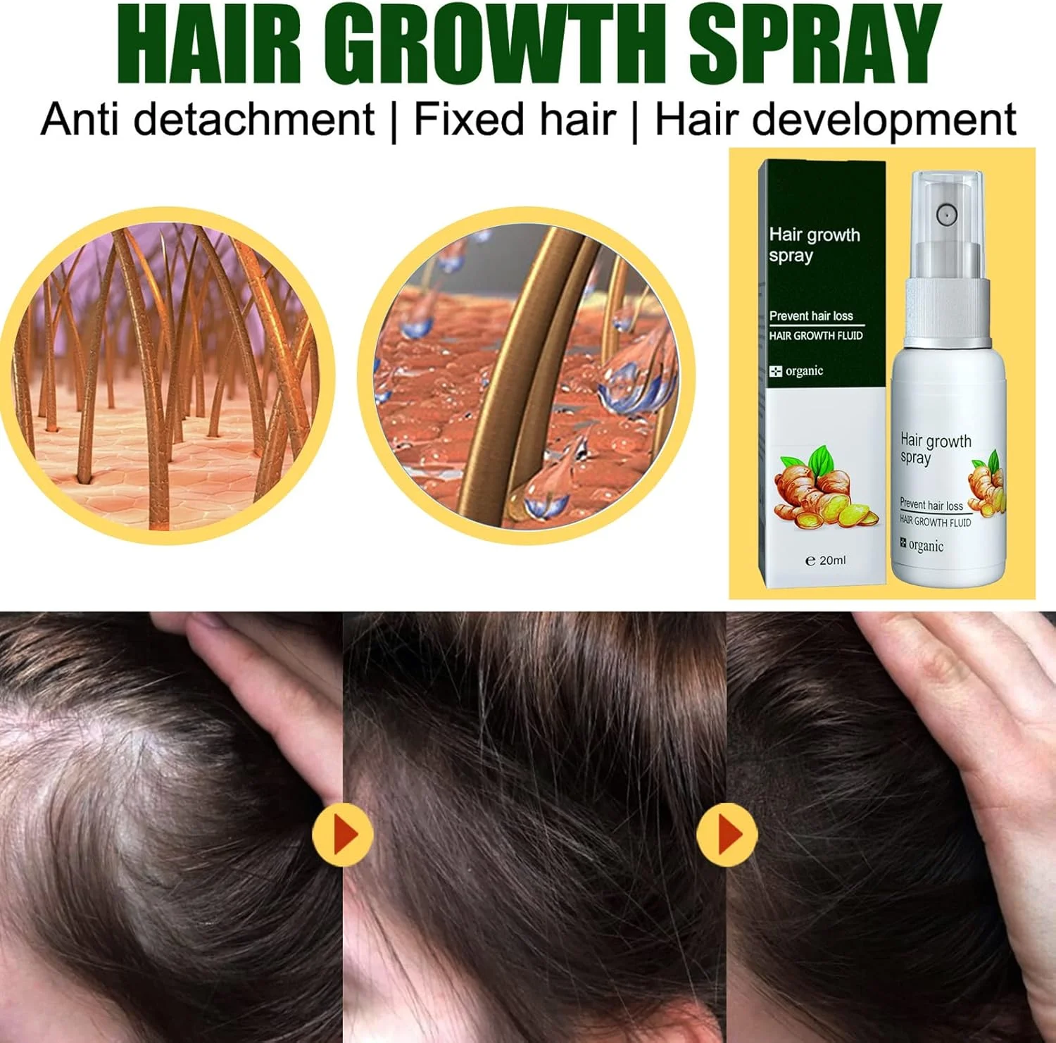 اسپری تقویت کننده مو، اسپری ضد ریزش مو، اسپری مراقبت از ریشه مو، اسپری ترمیم کننده مو، اسانس سفت کننده مو، اسانس متراکم کننده مو، رشد موهای قوی تر، ضخیم تر، بلندتر و سالم تر