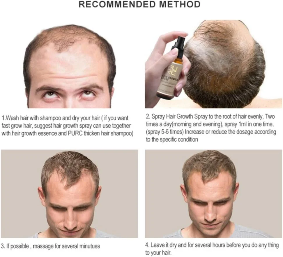 اسپری تقویت کننده و رشد سریع مو، درمان ریزش مو، مراقبت از مو، اسپری ضخیم کننده مو، اسپری اسانس رشد مو