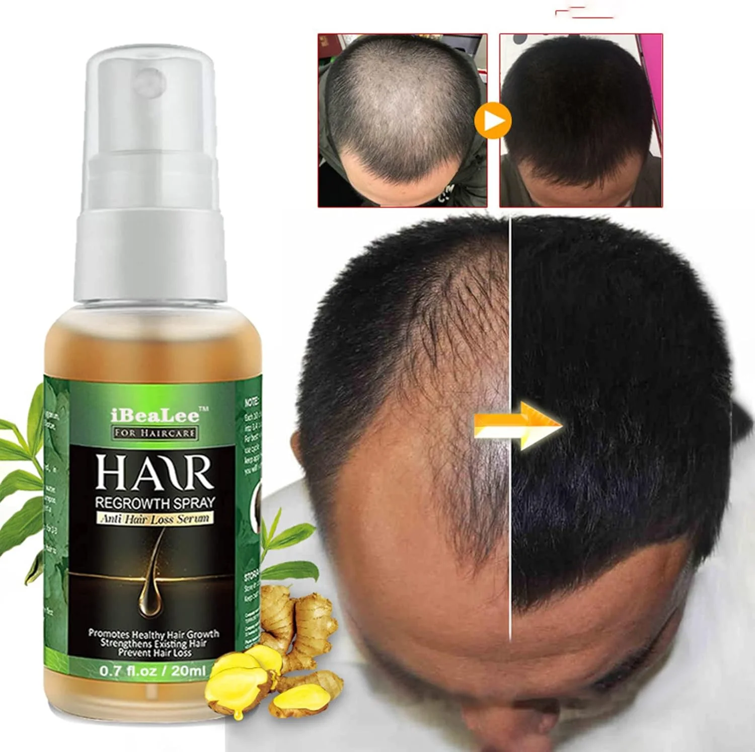 اسپری رشد مو، اسپری رشد مجدد مو زنجبیلی 20 میلی لیتری برای تغذیه ریشه مو، درمان های رشد مجدد مو برای مردان و زنان، اسپری زنجبیل مغذی رشد مجدد مو، ضد ریزش مو