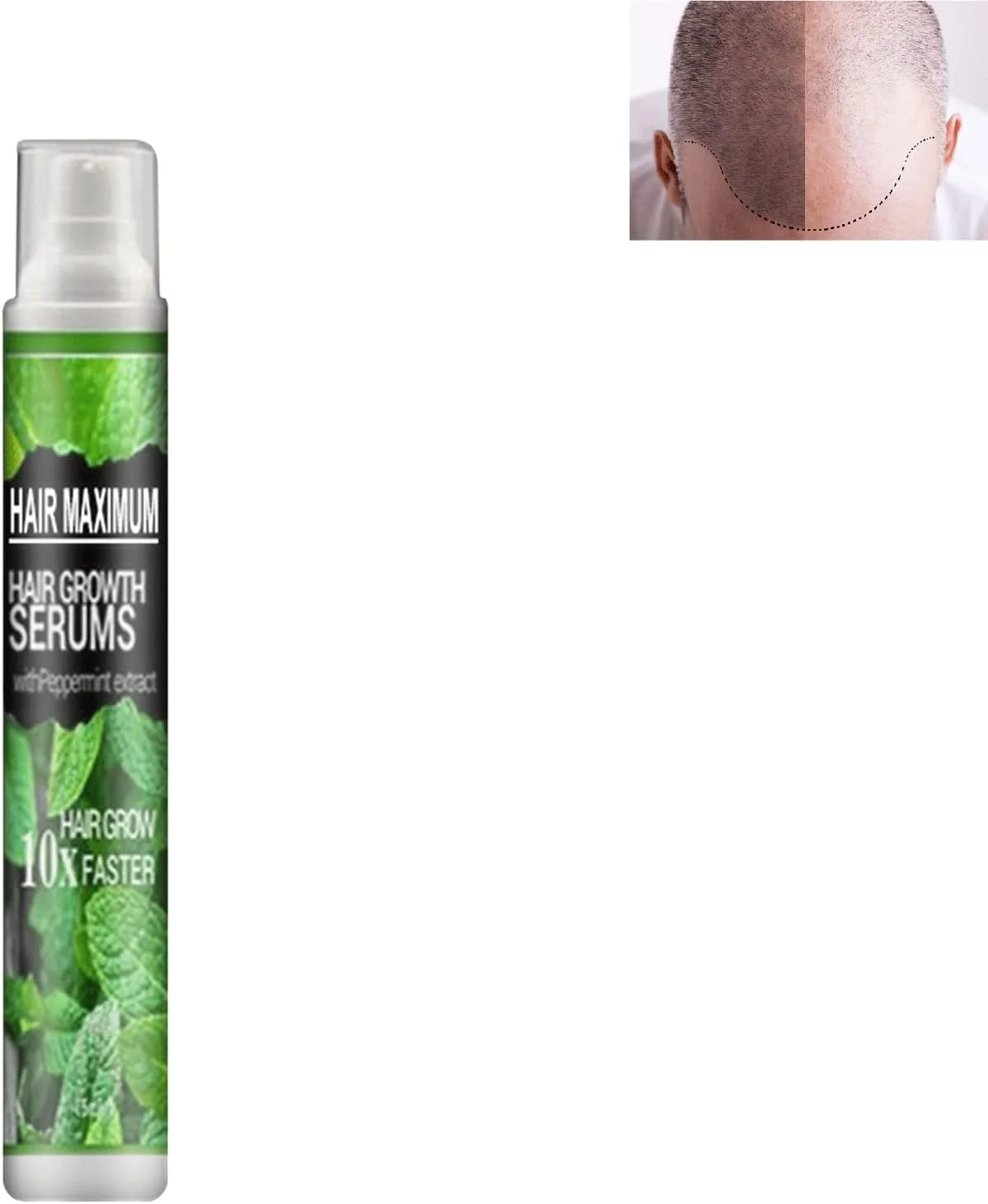 اسپری تقویت کننده مو حاوی عصاره گیاهی، اسپری گیاهی احیا کننده مو، اسپری سرم ضد ریزش مو، درمان های سریع رشد مو، روغن رشد مو برای ریزش مو (1 عدد)