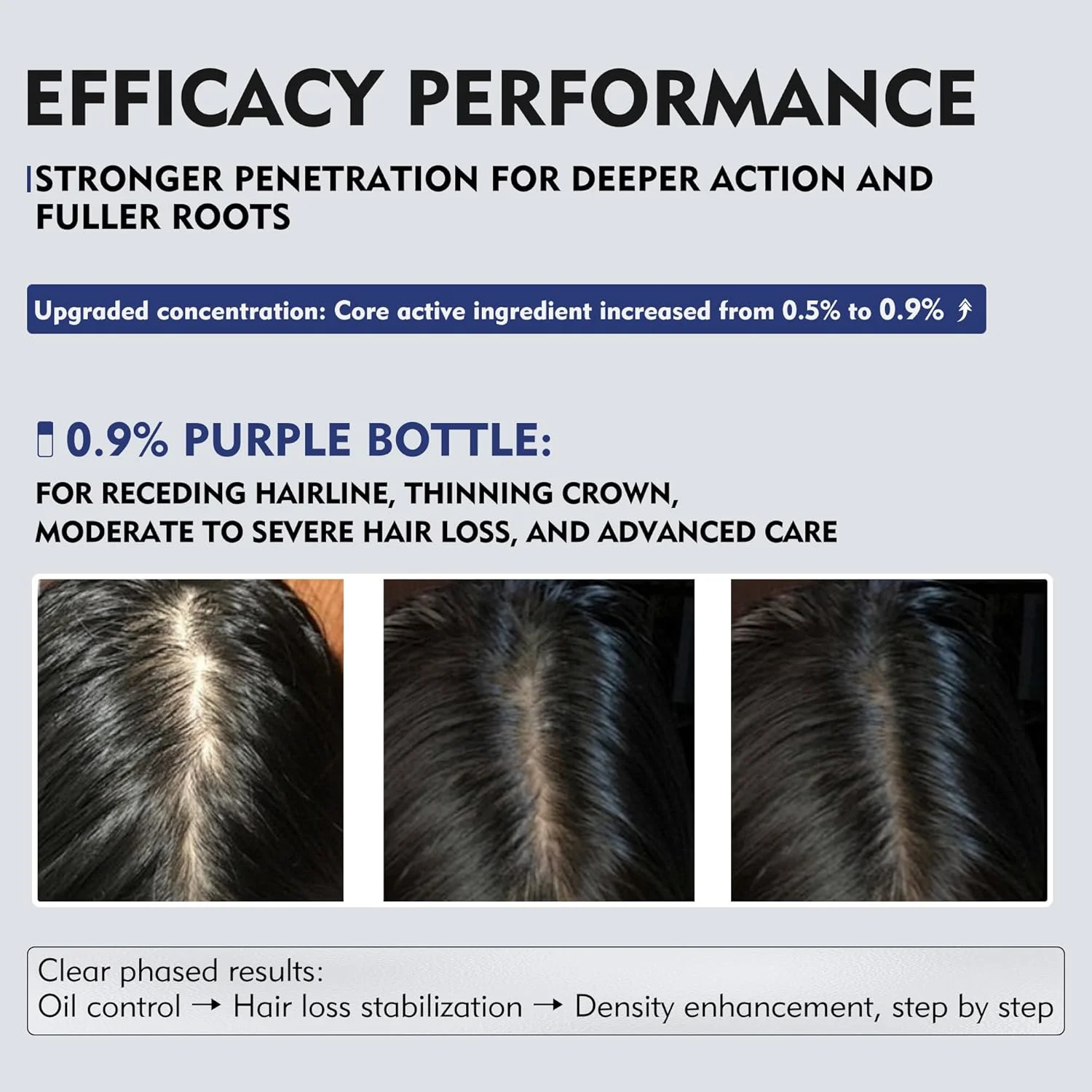 اسپری تقویت کننده و رشد مو KINTOR 0.9% KX-826 DHT Blocker مناسب آقایان و بانوان، 60 میلی لیتر