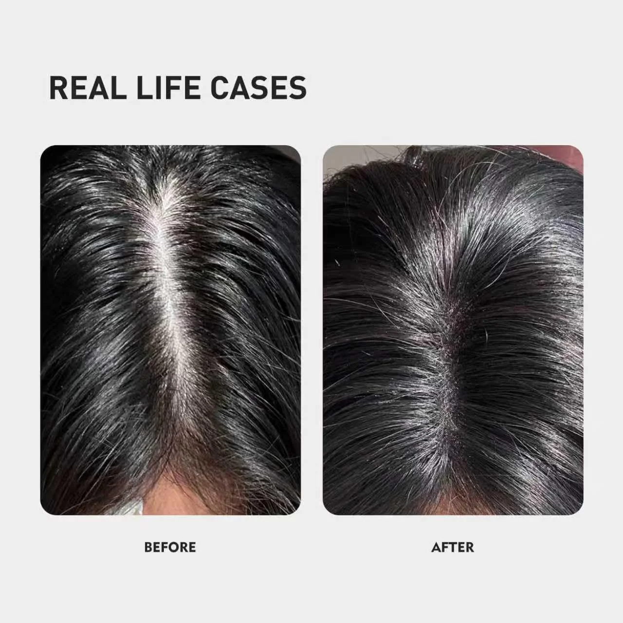 اسپری تقویت کننده و رشد مو KINTOR 0.9% KX-826 DHT Blocker مناسب آقایان و بانوان، 60 میلی لیتر