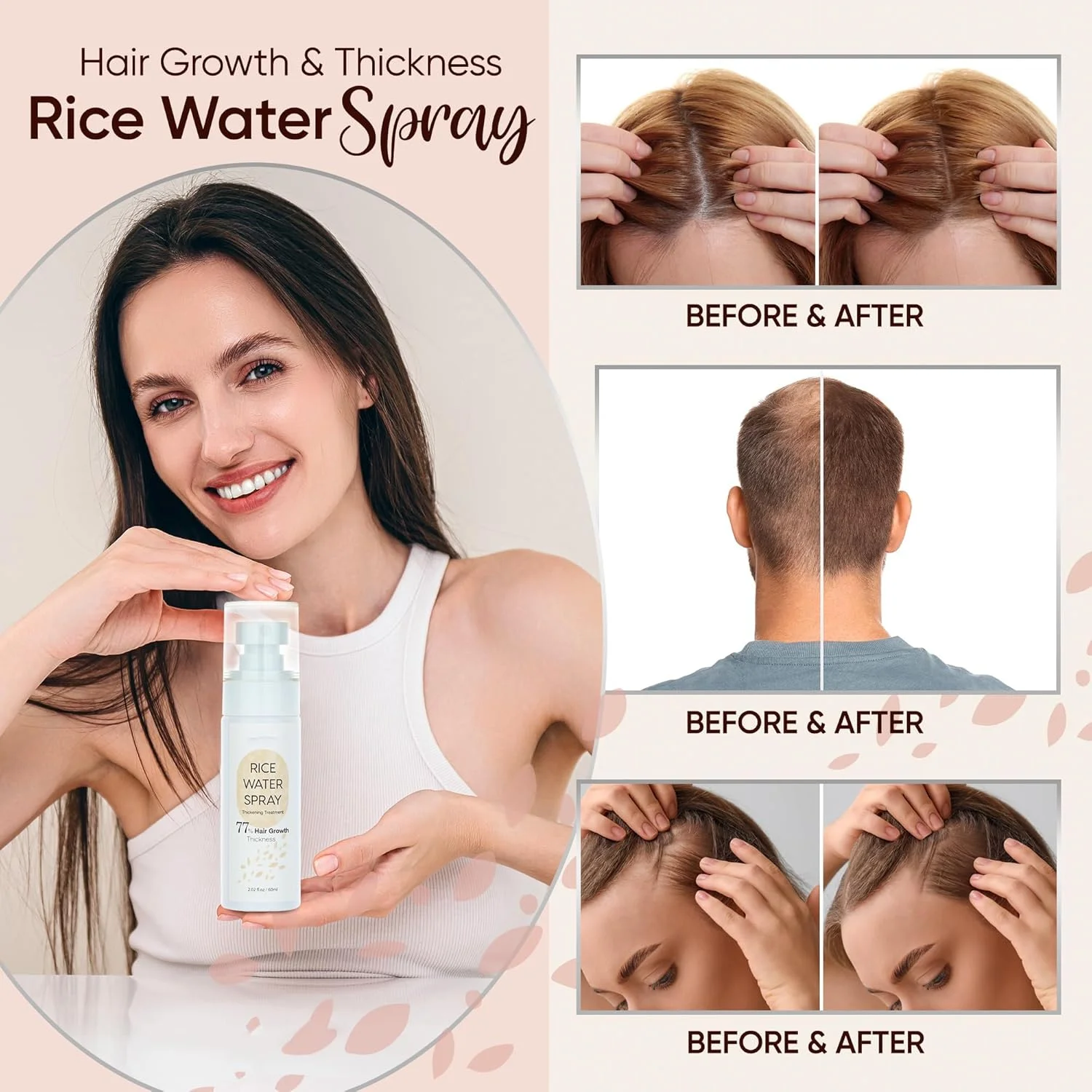 اسپری روغن تقویت کننده مو، سرم تقویت کننده مو، آب برنج تخمیر شده با بیوتین و روغن کرچک برای ضخیم شدن روزانه مو و تغذیه پوست سر - طبیعی و غیر چرب 60 میلی لیتر