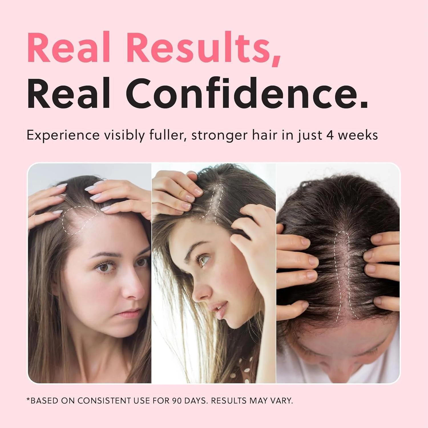 اسپری روغن تقویت کننده مو، روغن پیشرفته رشد مو برای افزایش ضخامت موهای طبیعی، ترمیم آسیب و جلوگیری از ریزش، فرمول غیر چرب و بدون هورمون، ایده آل برای پوست سر خشک