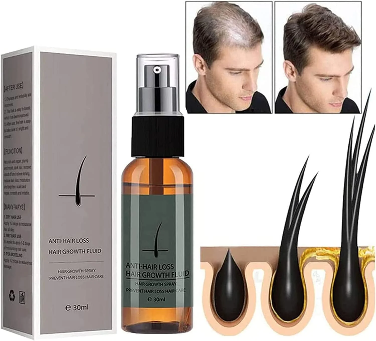 اسپری زنجبیل مغذی، اسپری سرم رشد مو زنجبیل، اسپری زنجبیل مغذی رشد مجدد، اسپری زنجبیل برای رشد مو، رشد طبیعی مو، ضد ریزش مو (1 عدد)