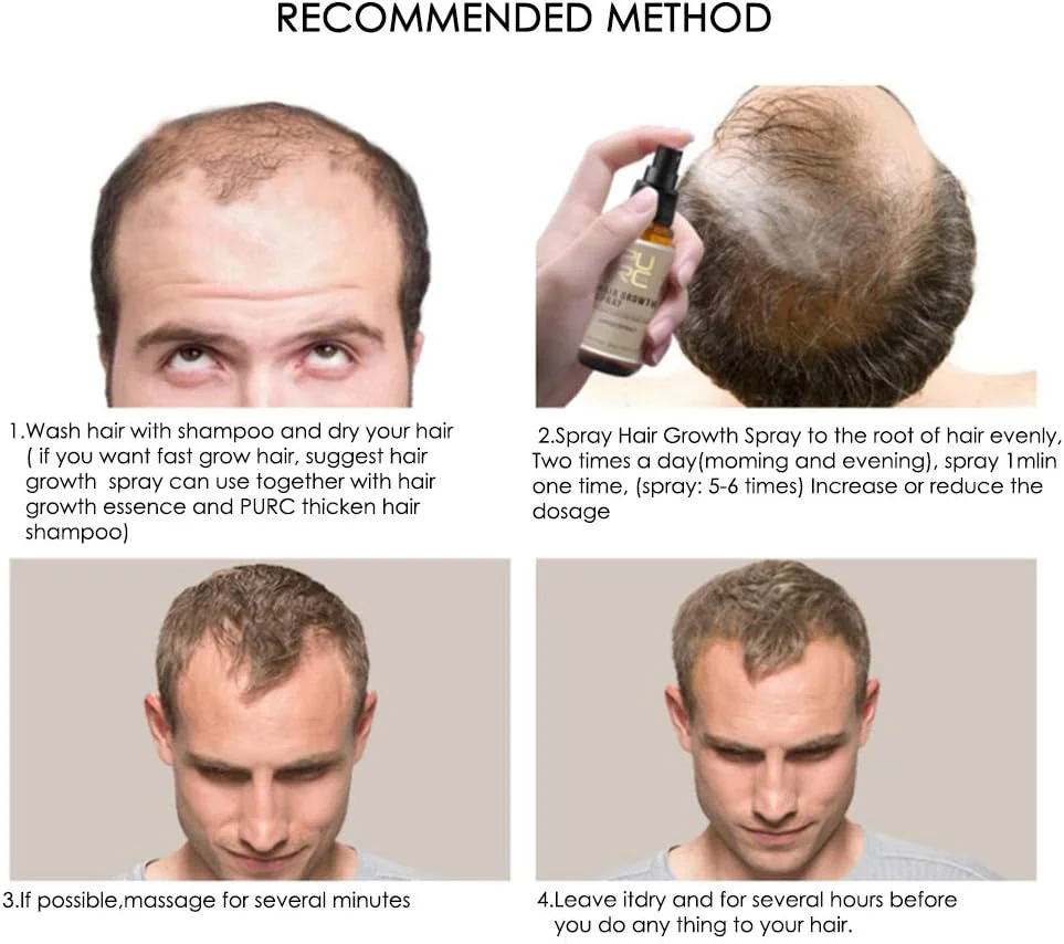 مجموعه زنجبیل ضد ریزش مو، مجموعه اسانس مراقبت از مو مغذی برای رشد مو شامل شامپو زنجبیل + اسپری رشد مو، کیت موی پاک کننده عمیق و تقویت کننده رشد مجدد طبیعی مجموعه زنجبیل ضد ریزش مو، مجموعه اسانس مراقبت از مو مغذی برای رشد مو شامل شامپو زنجبیل + اسپری رشد مو، کیت موی پاک کننده عمیق و تقویت کننده رشد مجدد طبیعی