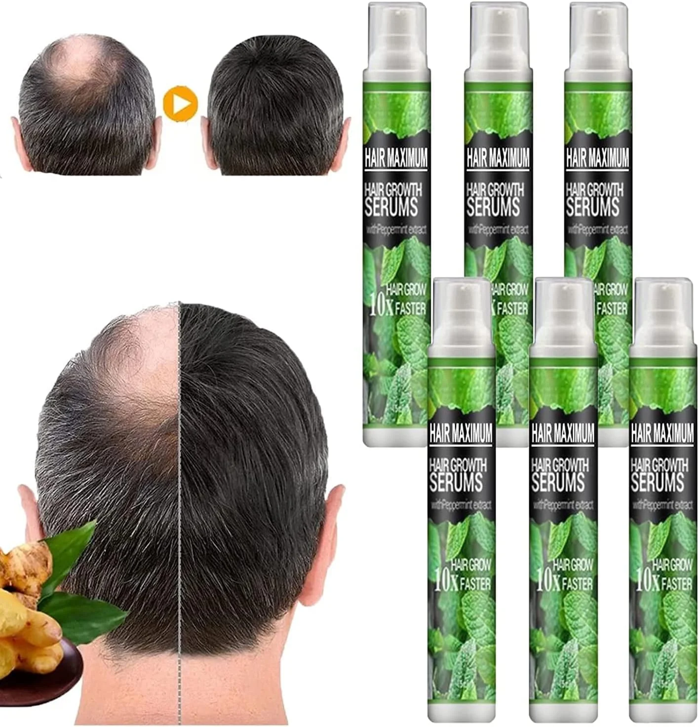 اسپری گیاهی احیا کننده مو، اسپری روغن ضروری مو برای رشد مو و جلوگیری از ریزش مو، روغن مغذی احیا کننده رشد مو (6 عدد)