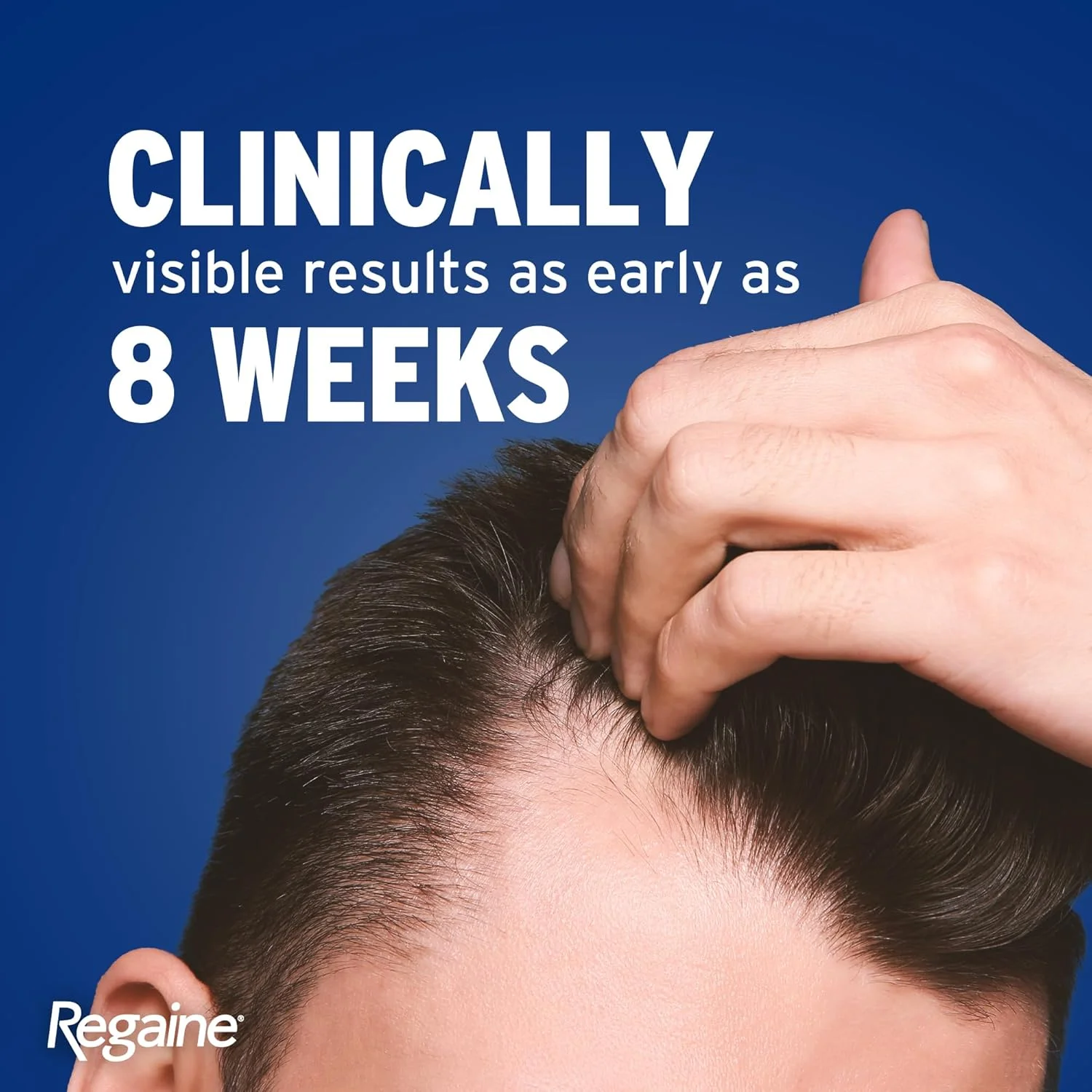 فوم 5% روگین مخصوص آقایان (60 گرم)، درمان پیشرفته برای رشد مجدد مو در آقایان، فرمول Minoxidil با اثبات بالینی برای کمک به رشد مجدد مو و ضخیم شدن موهای نازک، بسته تکی