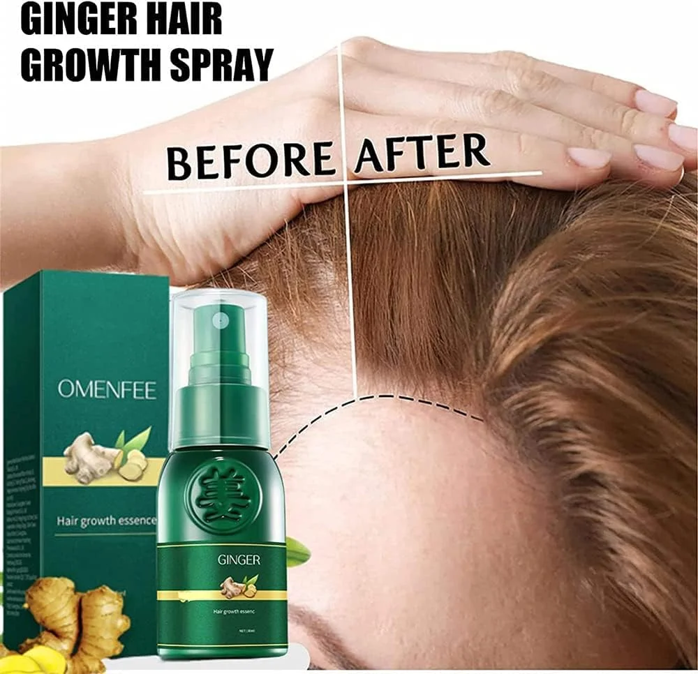 اسپری رشد موی ژاپنی شوگاگرو، اسپری سرم احیا کننده موی جینسینگ کره ای هیون گانگ، سرم اسپری رشد موی زنجبیل 7 روزه، محصولات ضد ریزش مو اسنس احیا کننده مو بوتانیکس (4 عدد)