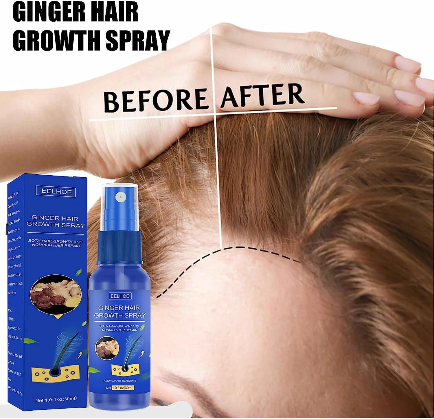 اسپری عصاره زنجبیل برای ضخیم شدن مو، سرم ضد ریزش مو زنجبیلی، اسپری سرم ضد ریزش مو جینگرو، اسپری رشد مو زنجبیل، 30 میلی لیتر (1 عدد)