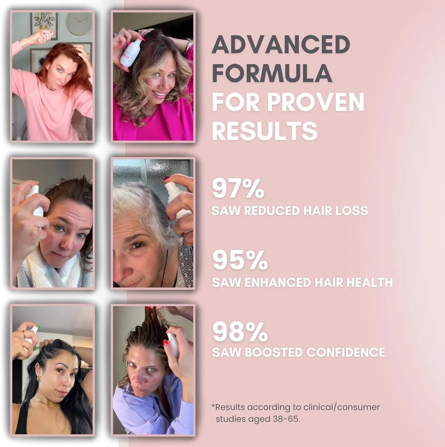 اسپری رشد مو H-Regrow – حاوی آب برنج، بیوتین، آلوئه ورا، کافئین و زنجبیل – محصول رشد مو برای آقایان و بانوان – برای پوست سر نازک